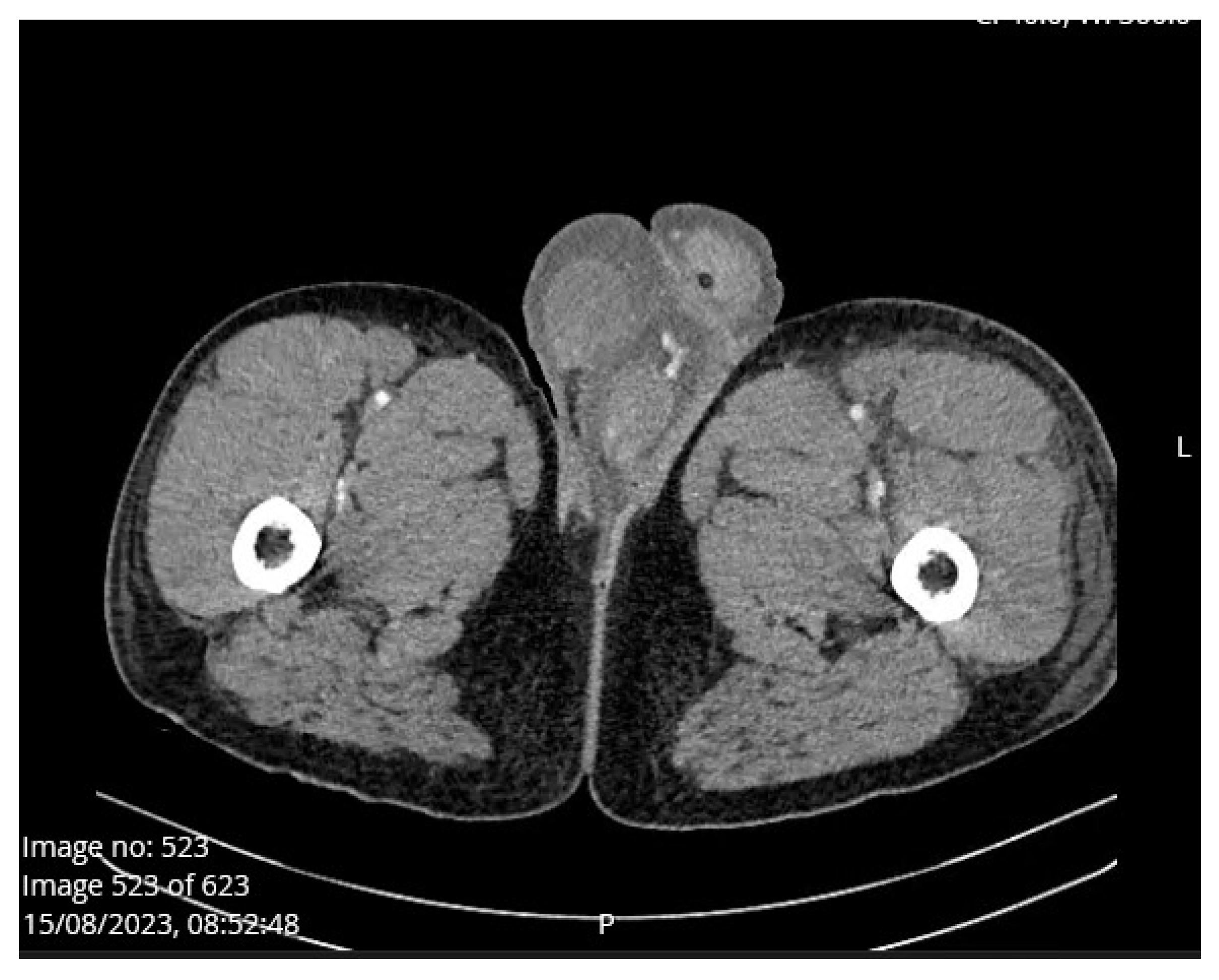 Medicina 60 00820 g002
