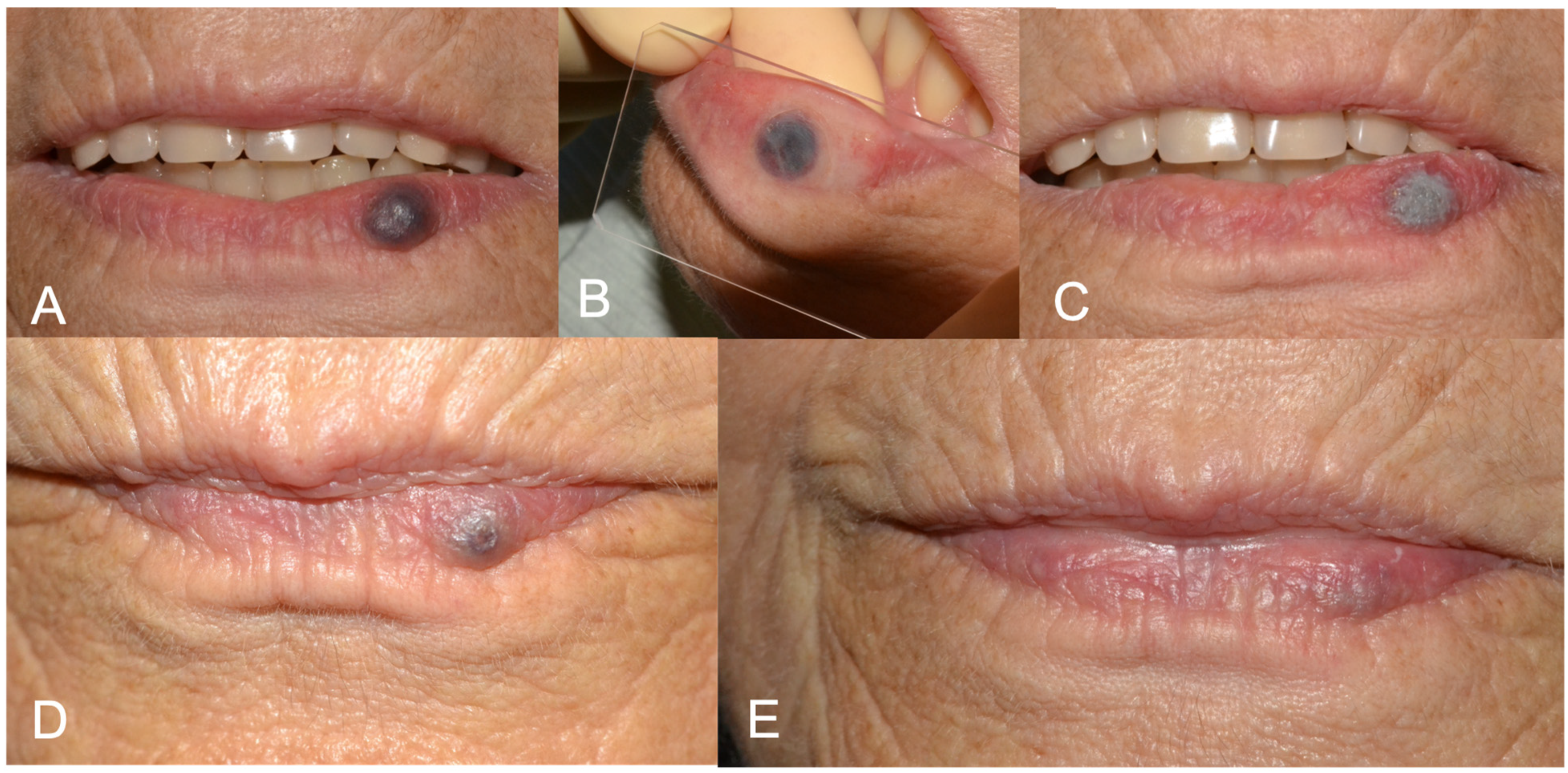 Medicina 60 00822 g001