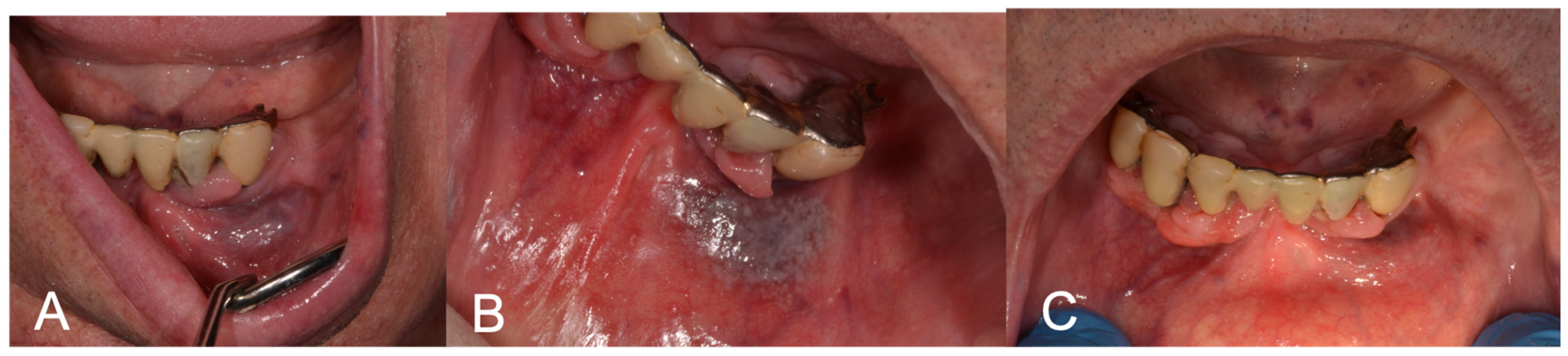 Medicina 60 00822 g002