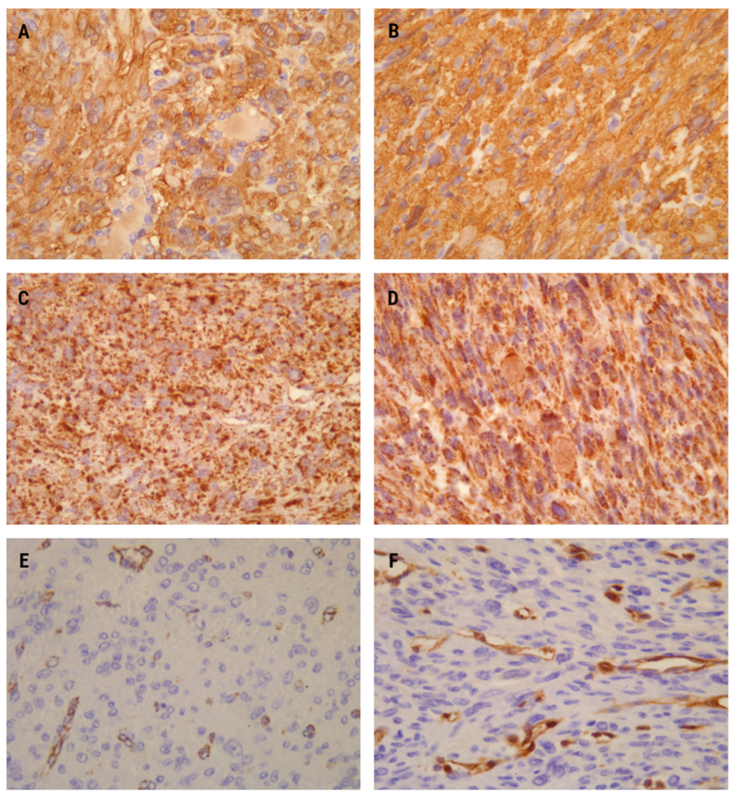 Medicina 60 00825 g003