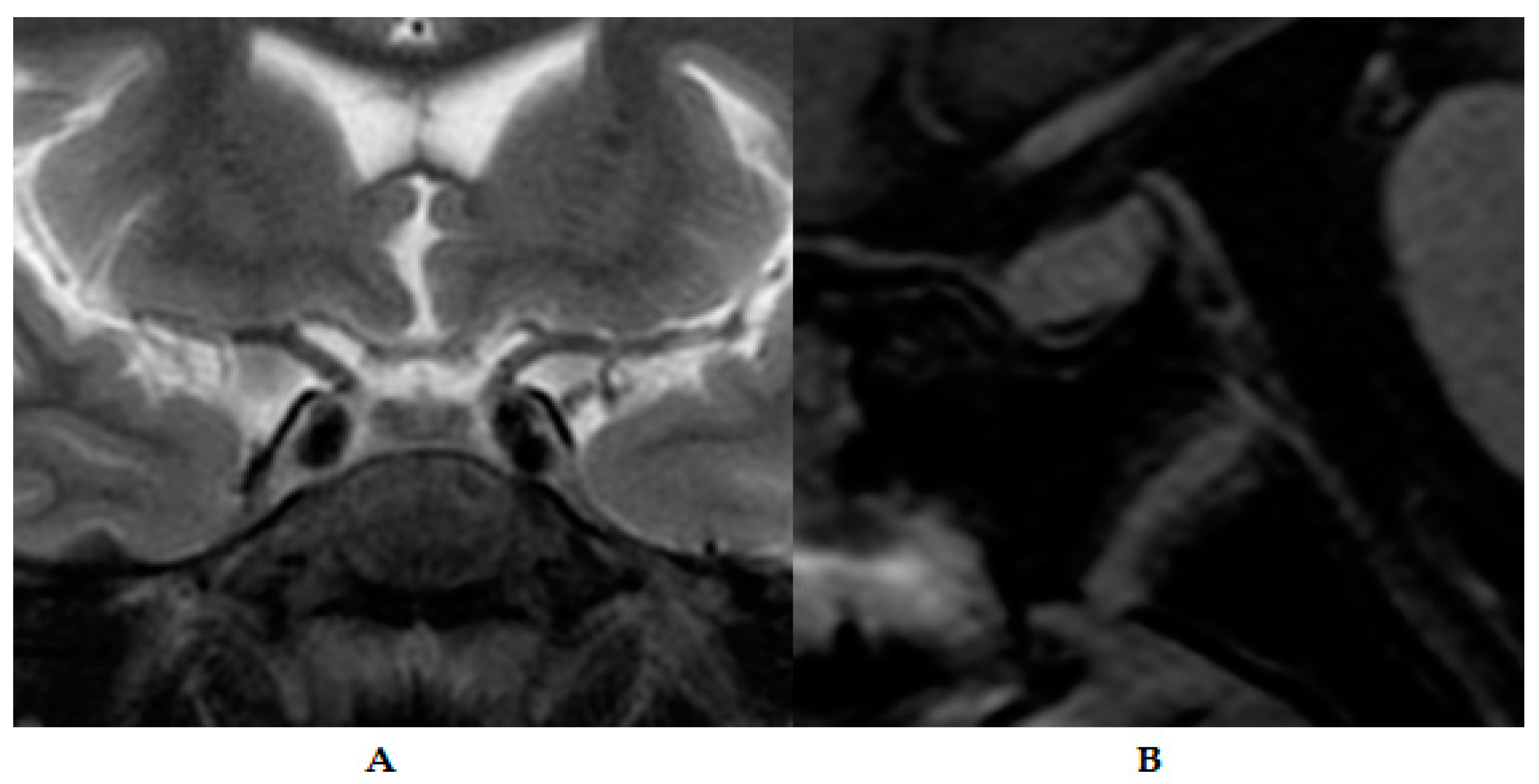 Medicina 60 00830 g003
