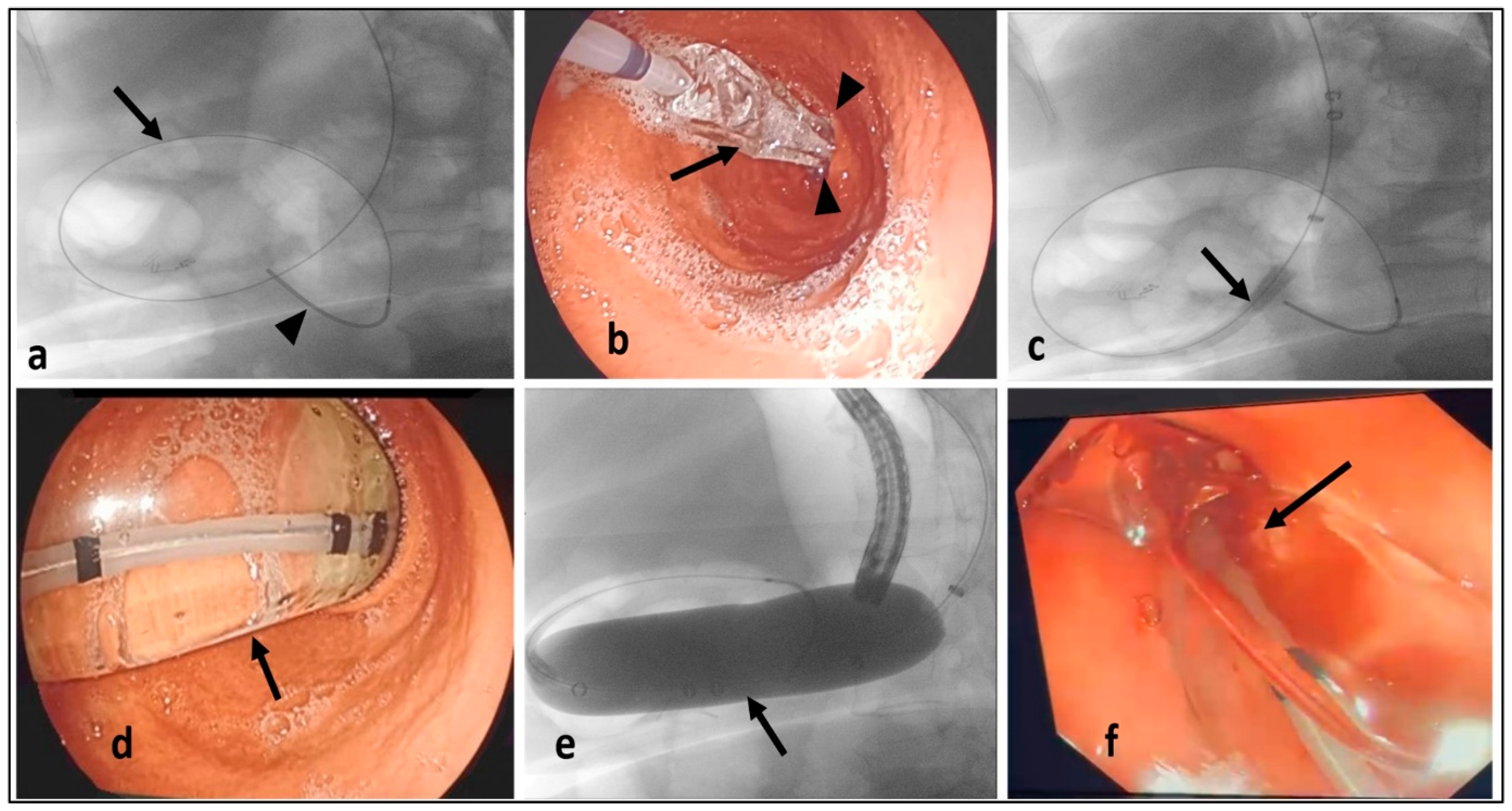Medicina 60 00833 g002