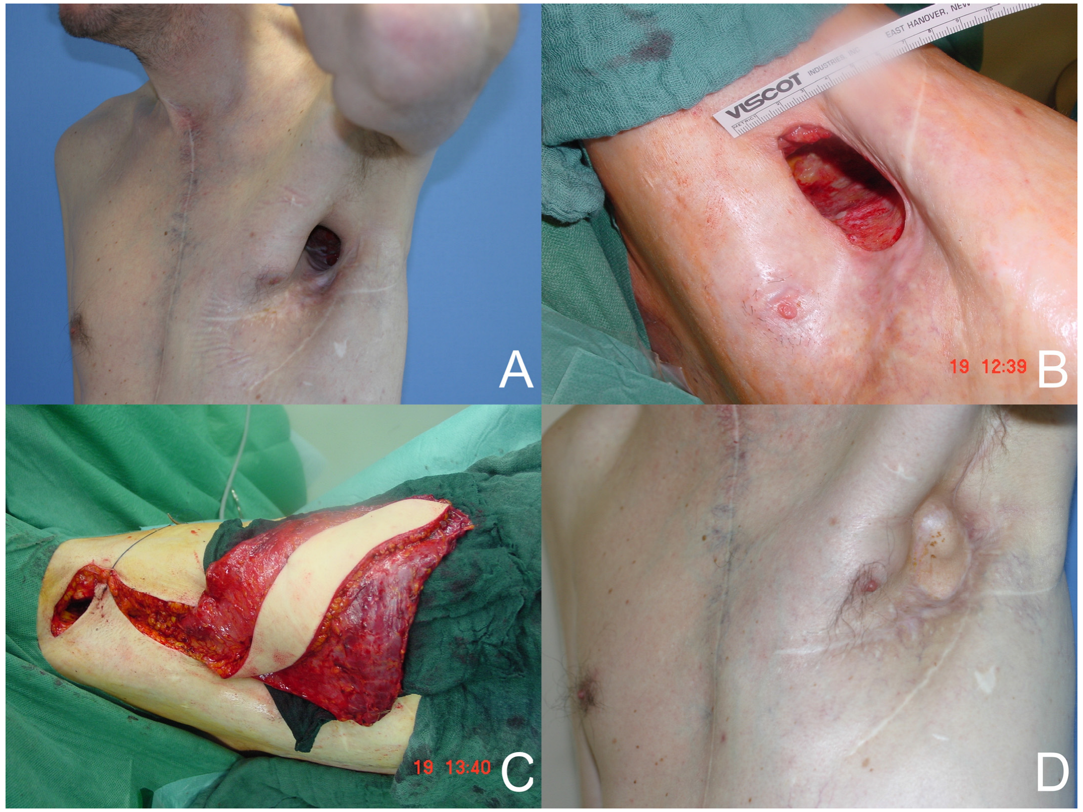 Medicina 60 00834 g001