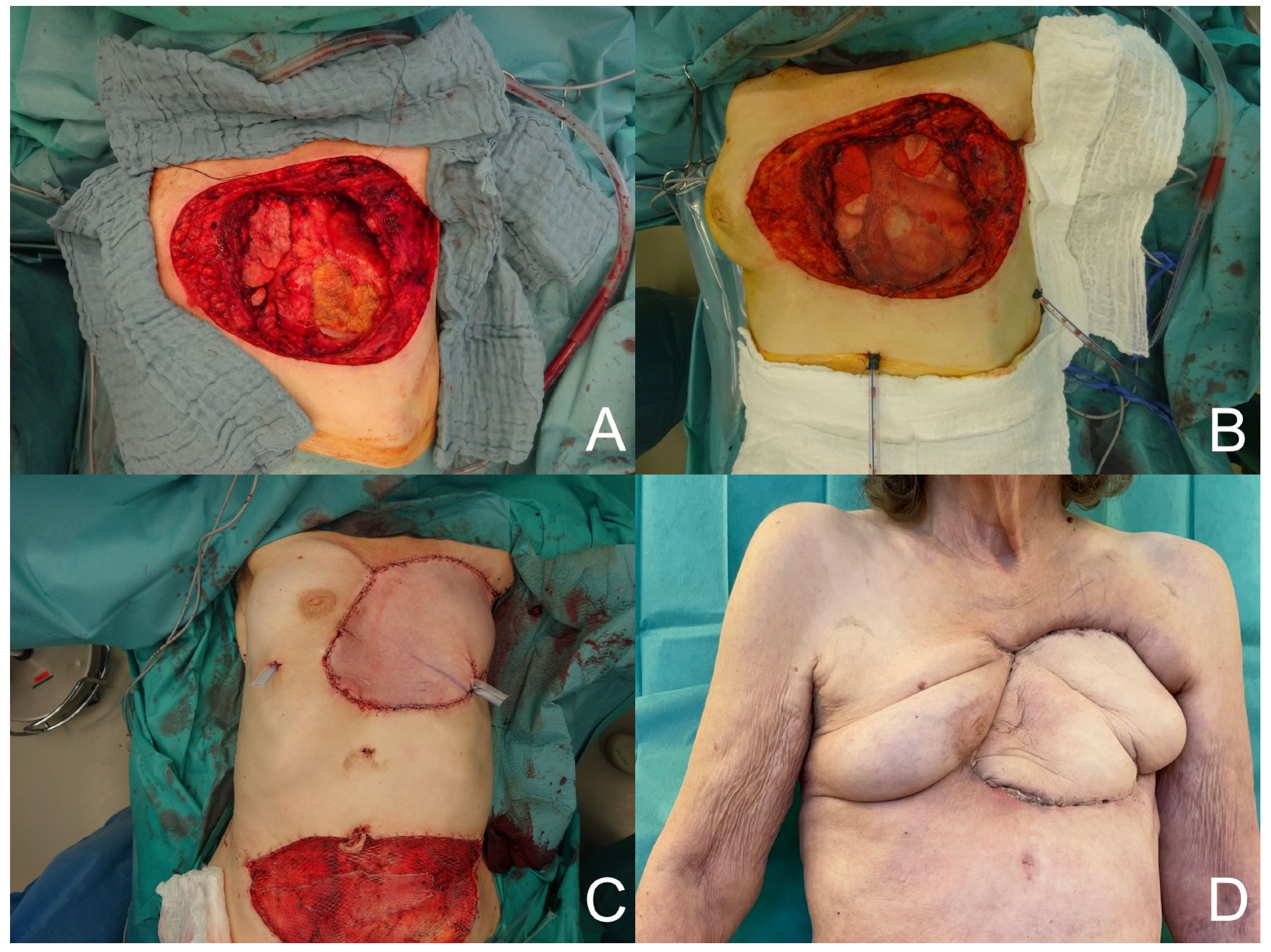Medicina 60 00834 g002