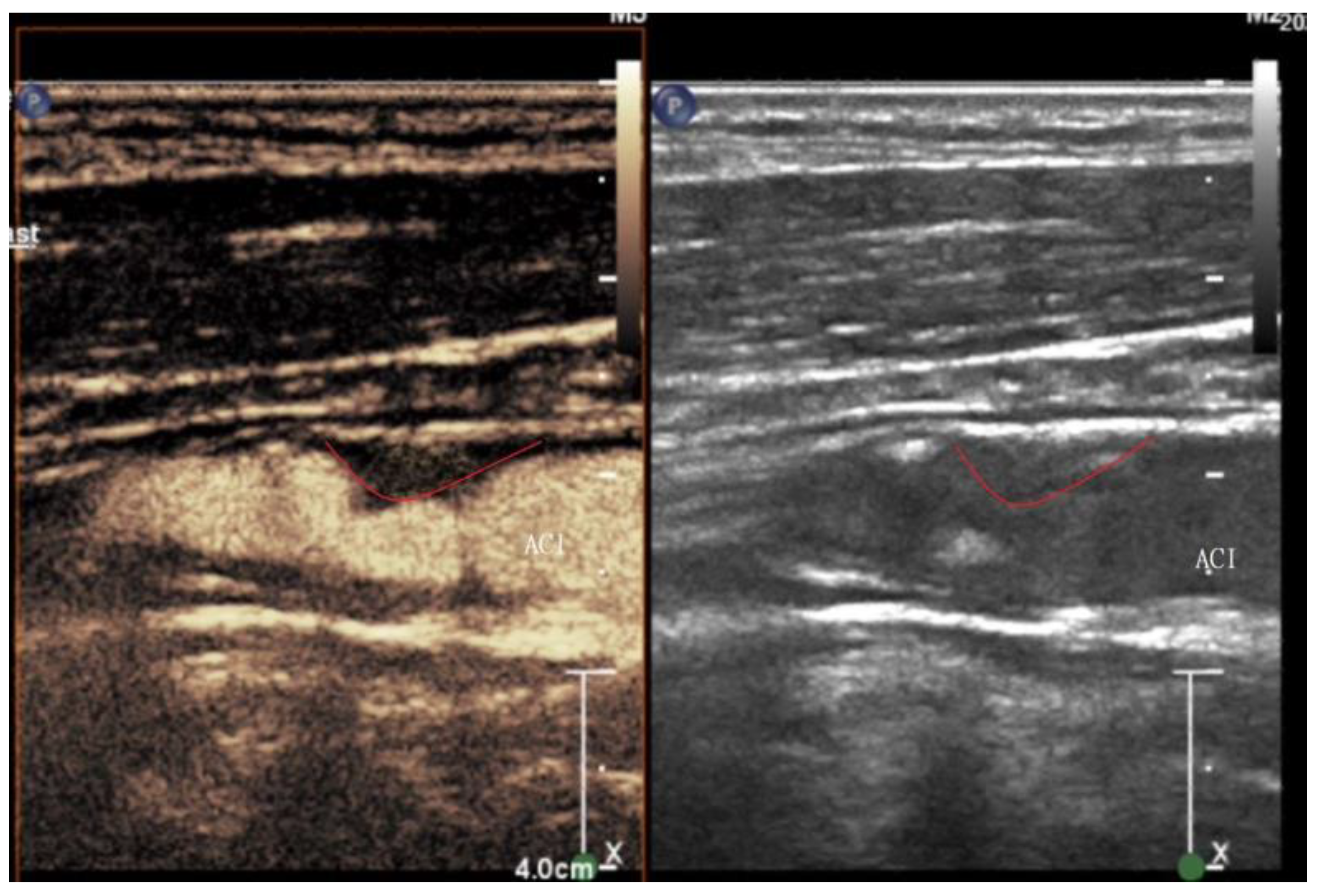 Medicina 60 00836 g001