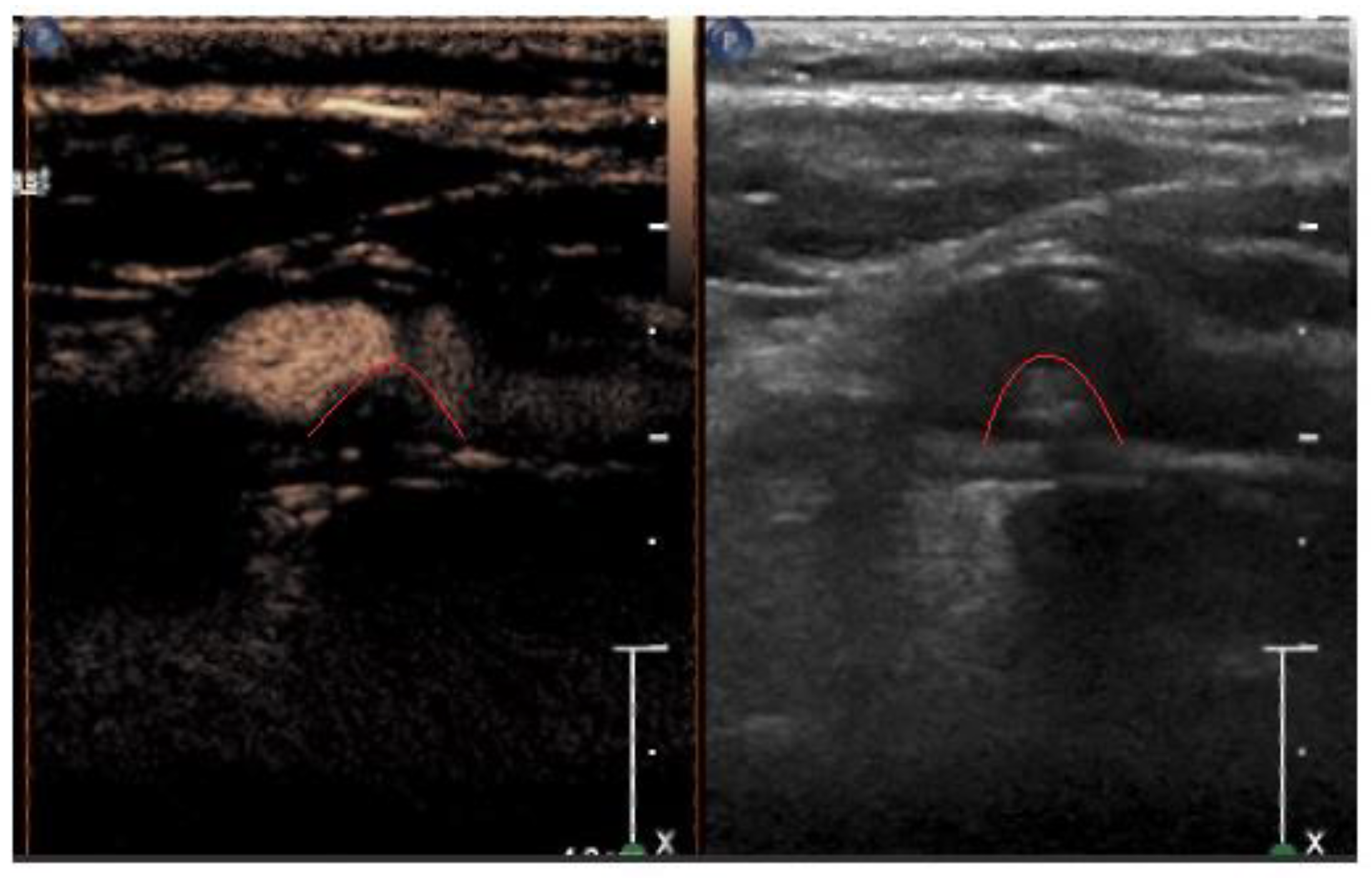 Medicina 60 00836 g002