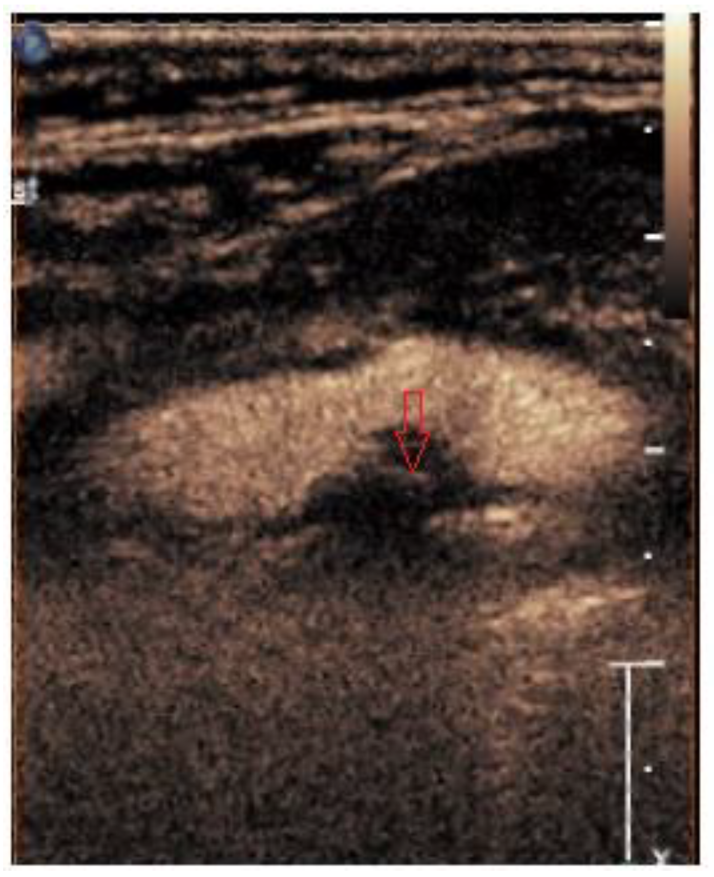 Medicina 60 00836 g003