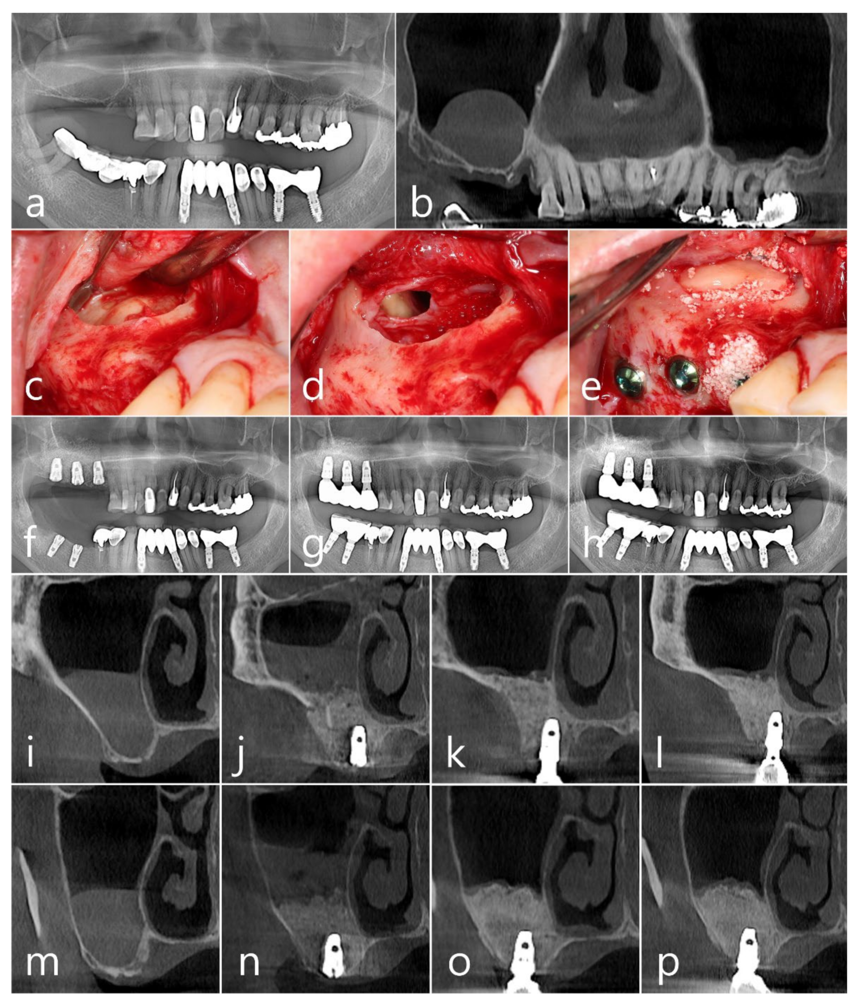 Medicina 60 00838 g002