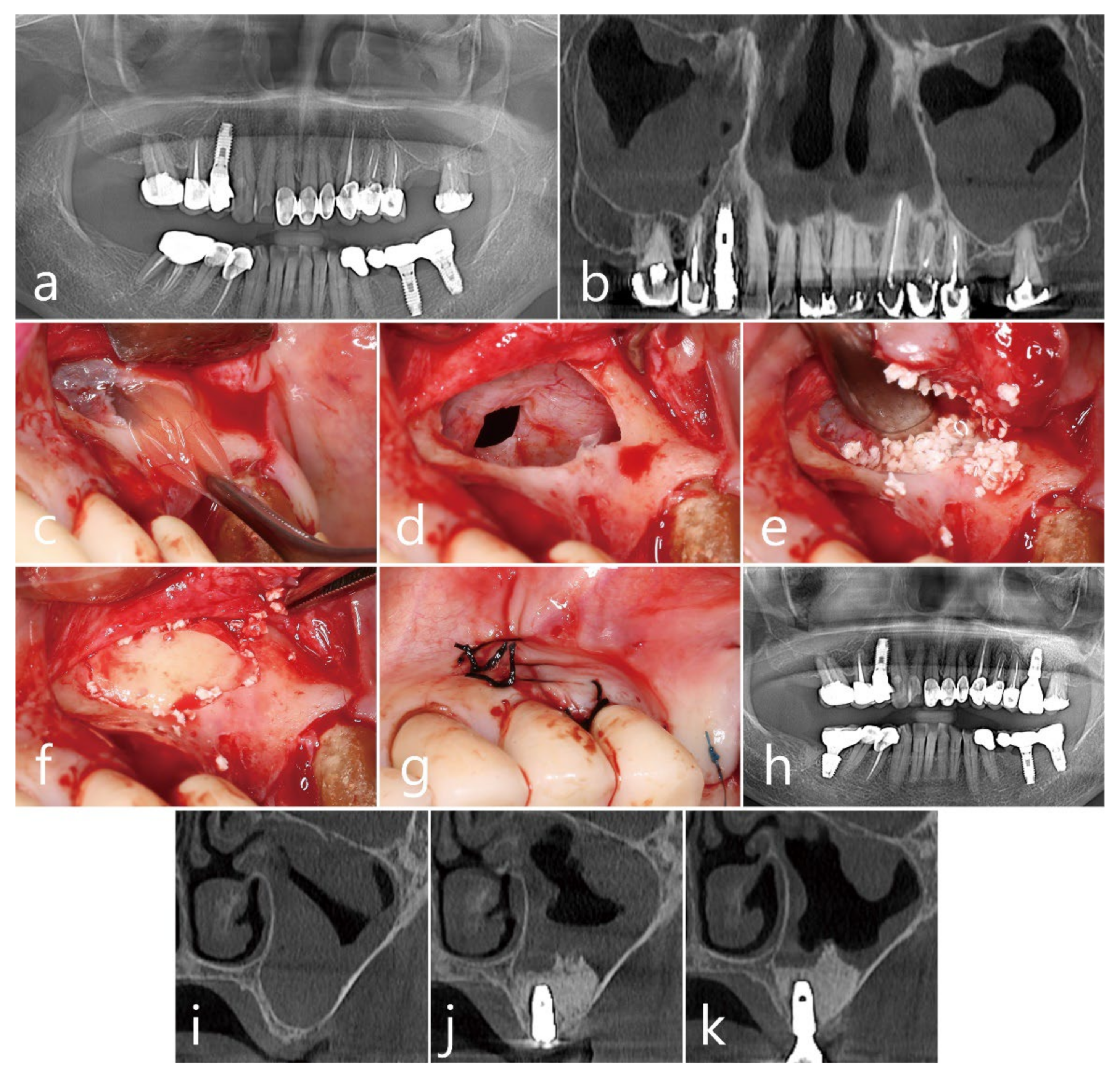 Medicina 60 00838 g003