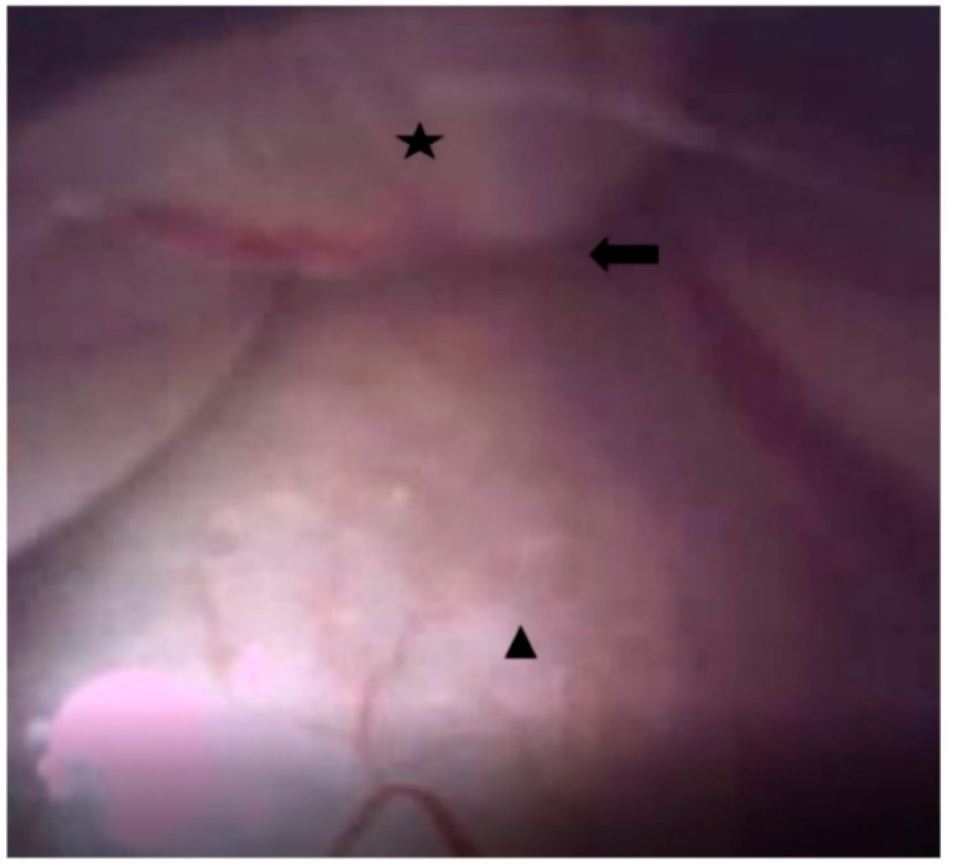 Medicina 60 00839 g003