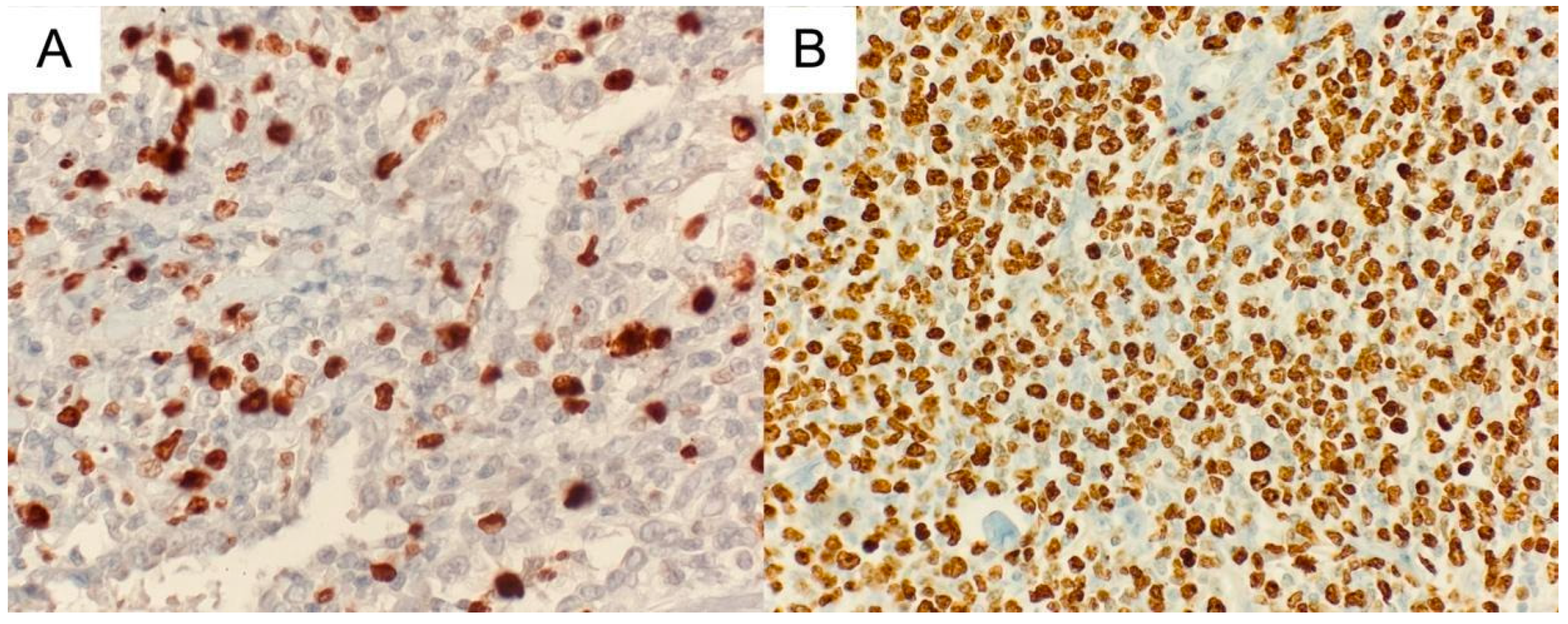 Medicina 60 00840 g005