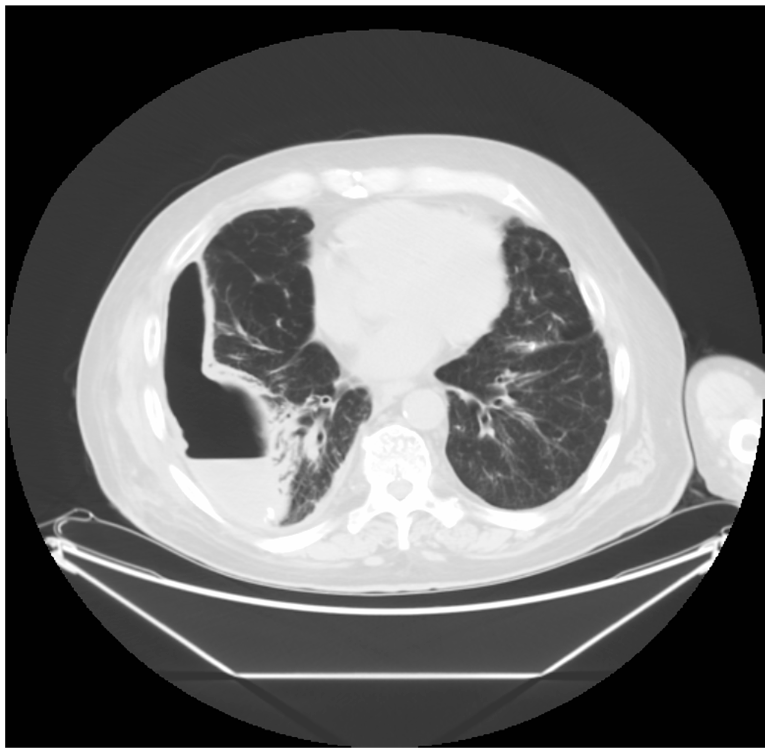 Medicina 60 00840 g007