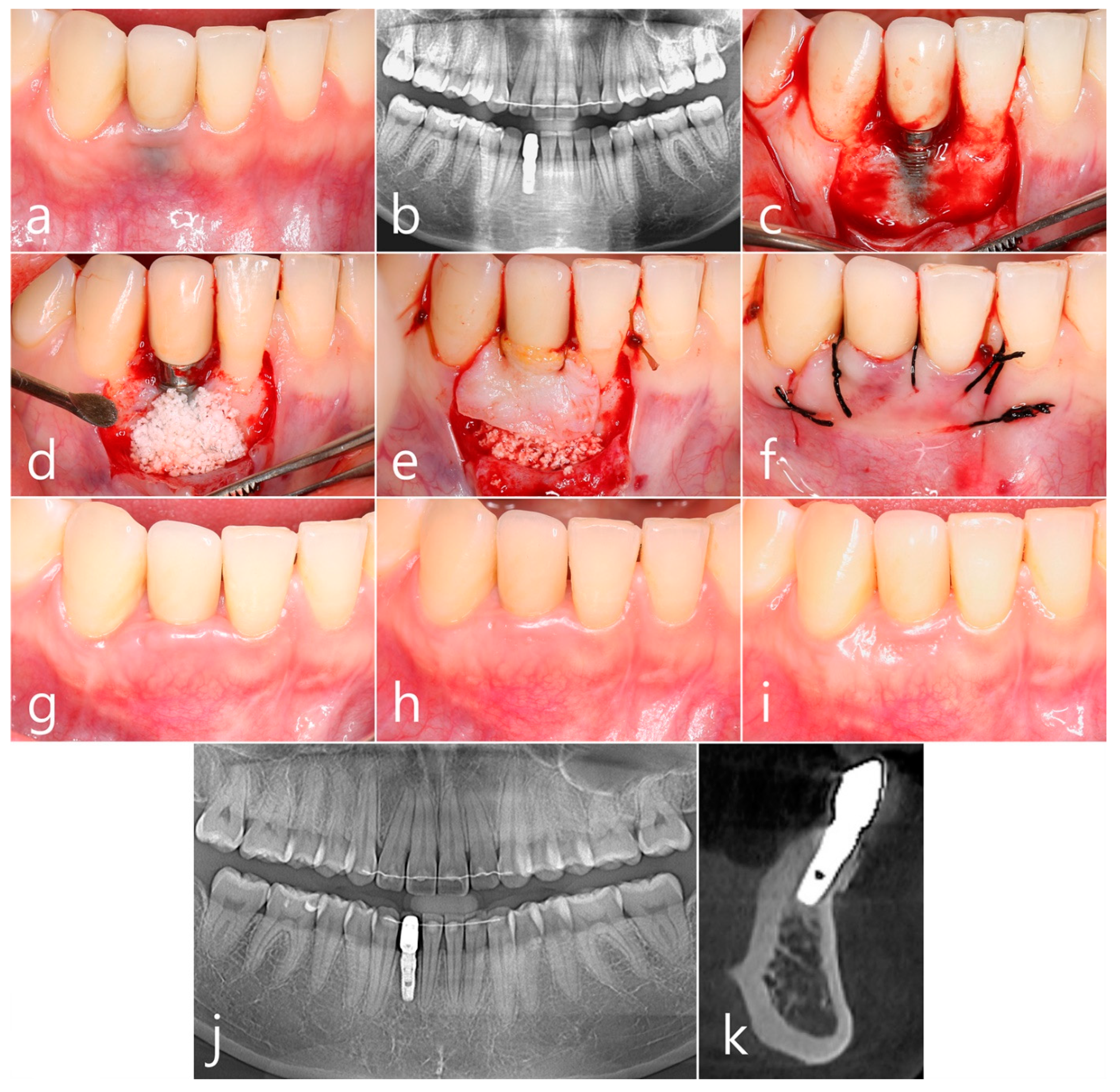 Medicina 60 00841 g002
