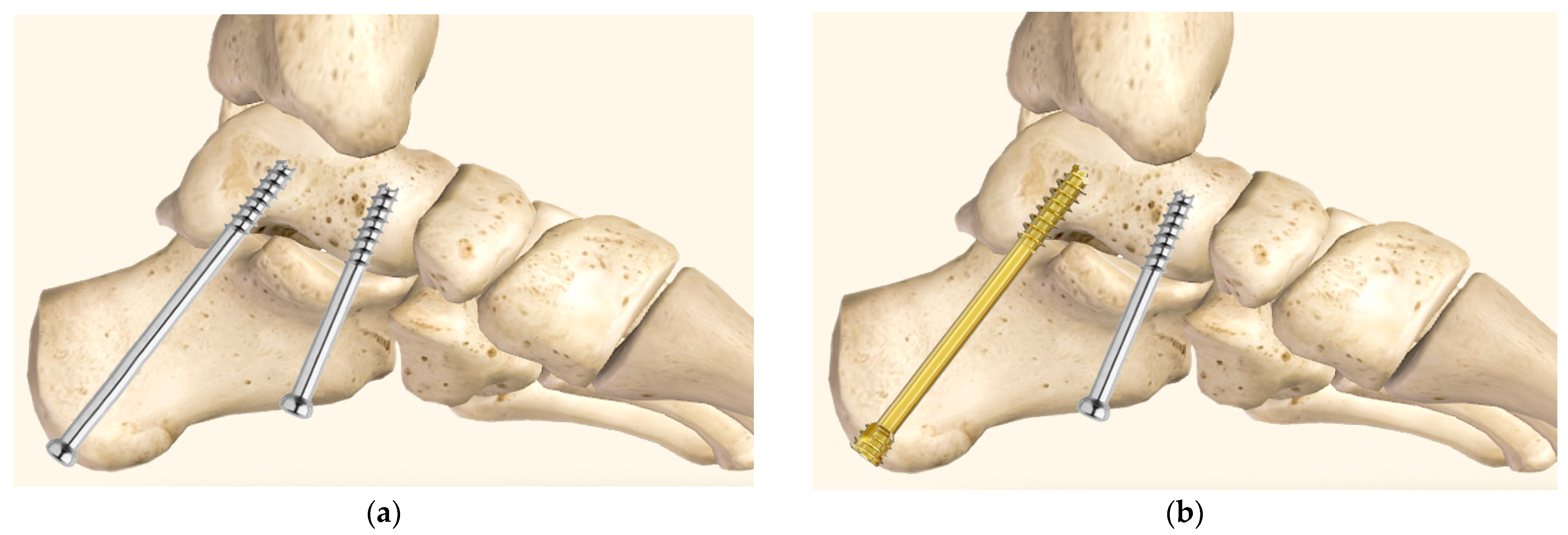 Medicina 60 00844 g002