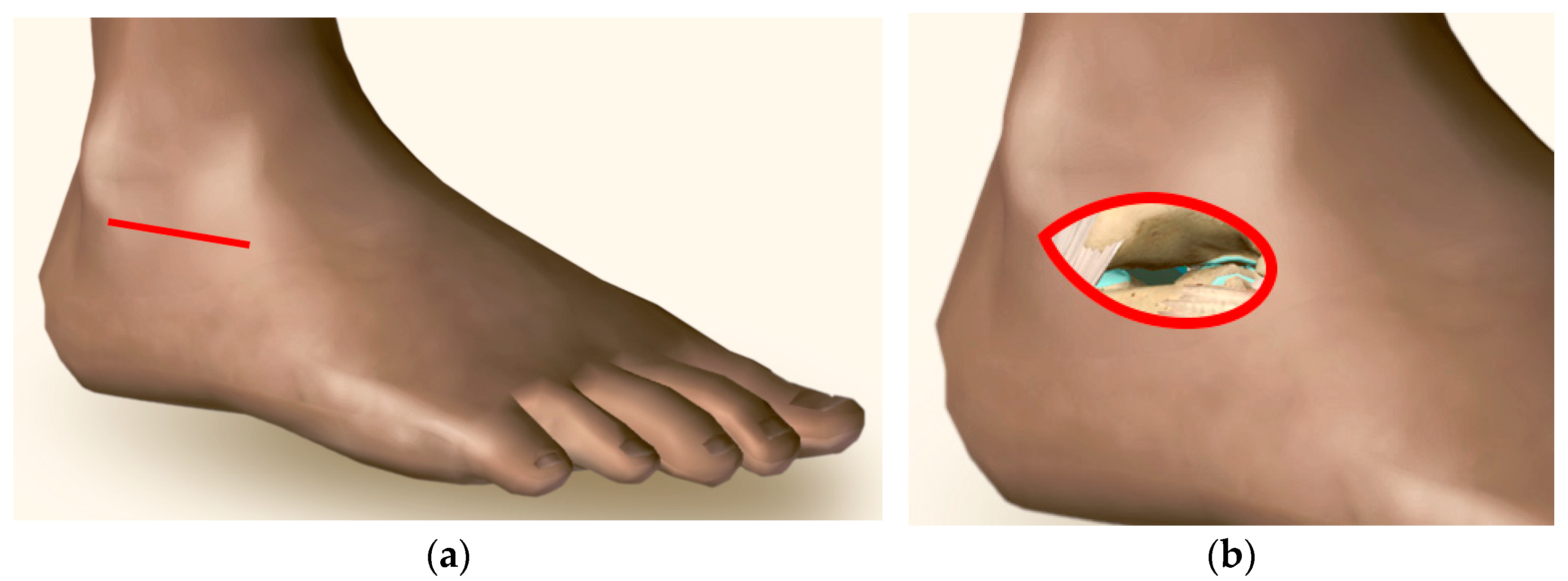 Medicina 60 00844 g003