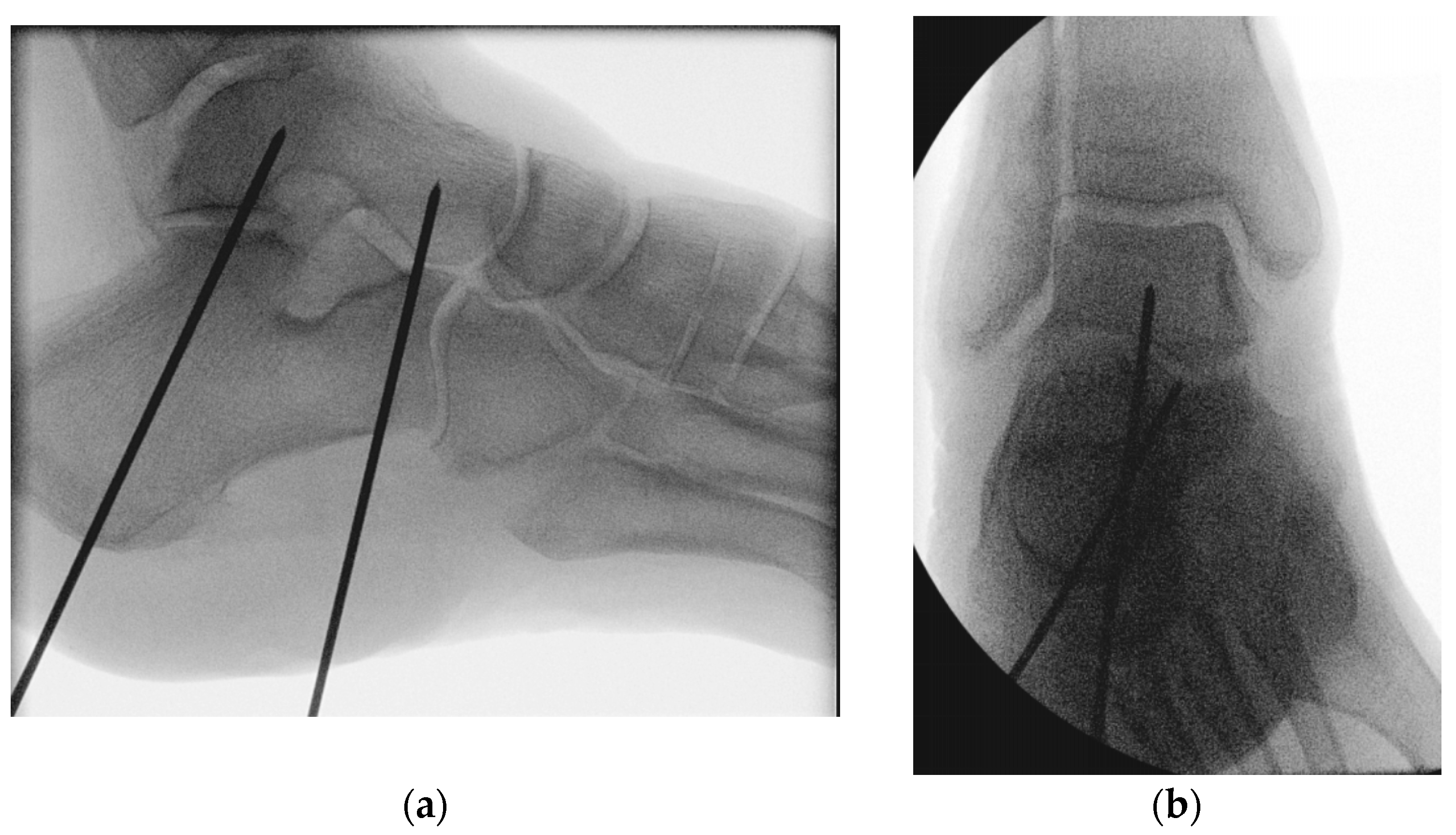 Medicina 60 00844 g004