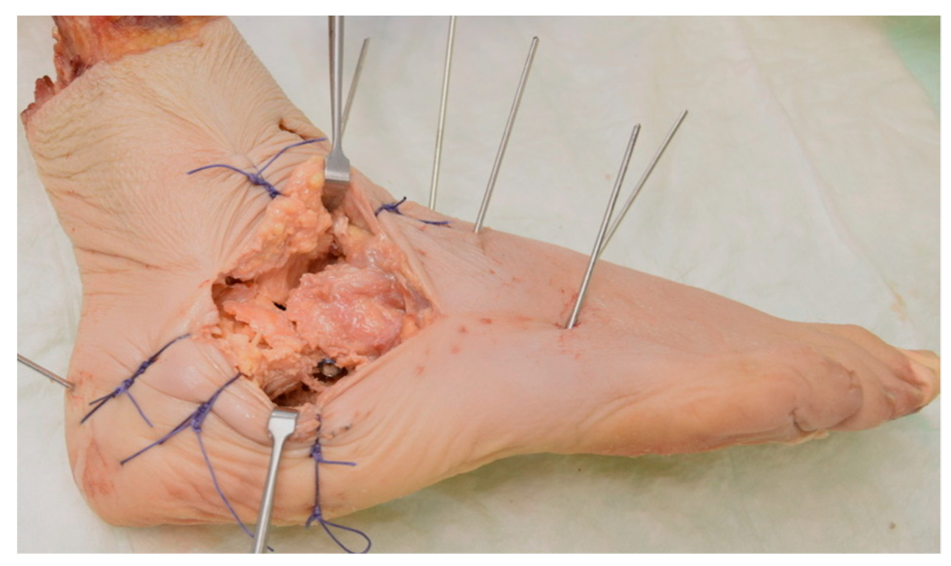 Medicina 60 00844 g007