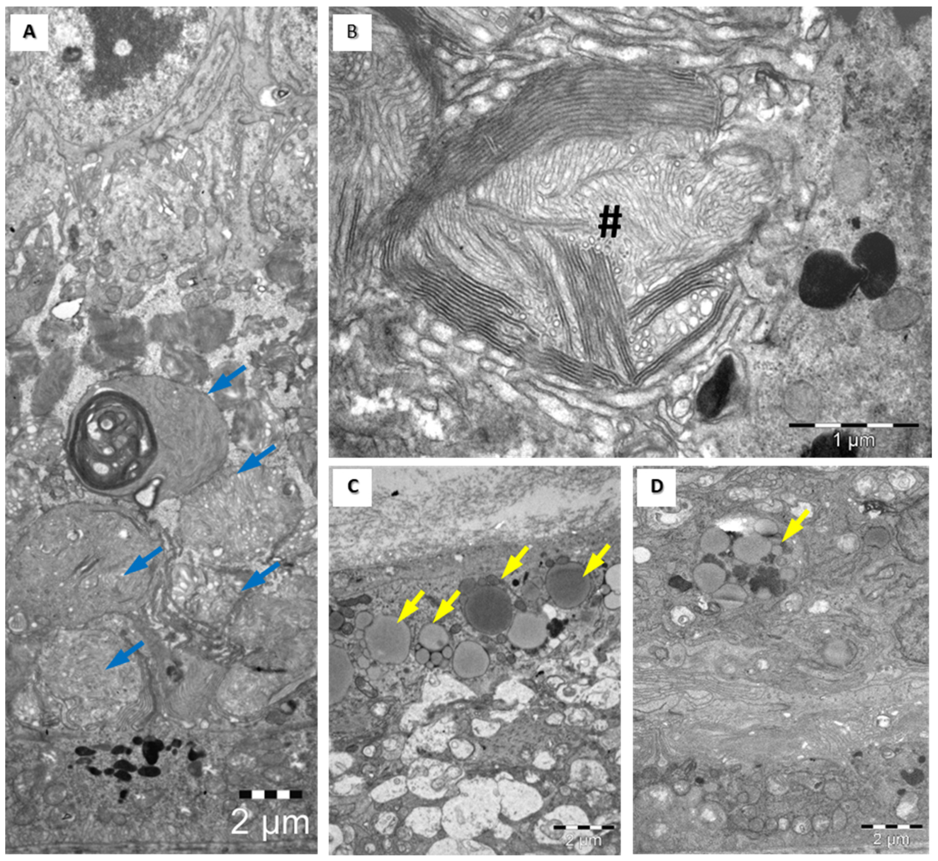 Medicina 60 00846 g005
