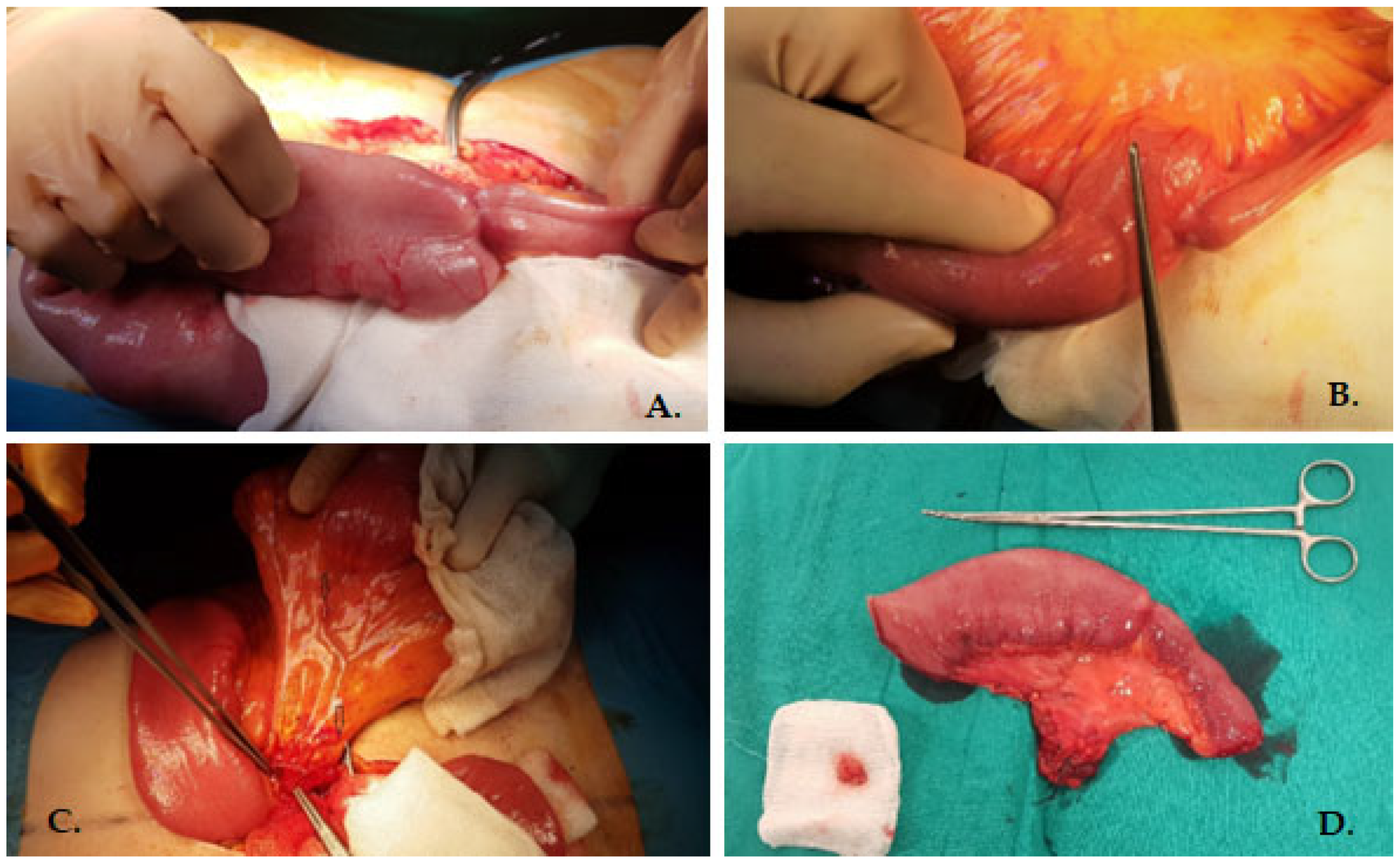 Medicina 60 00847 g002