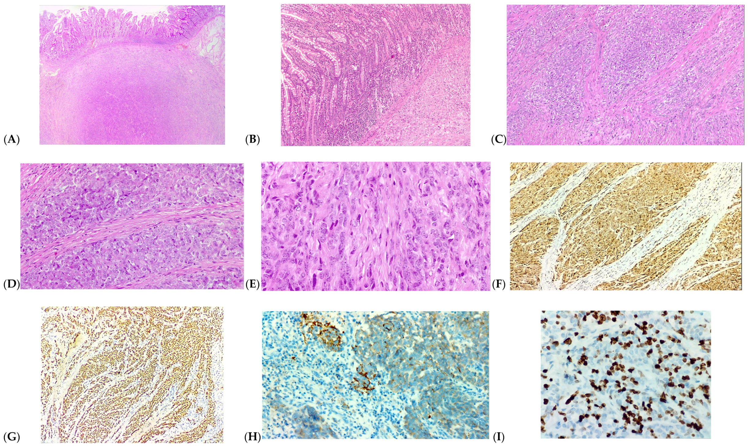 Medicina 60 00847 g003