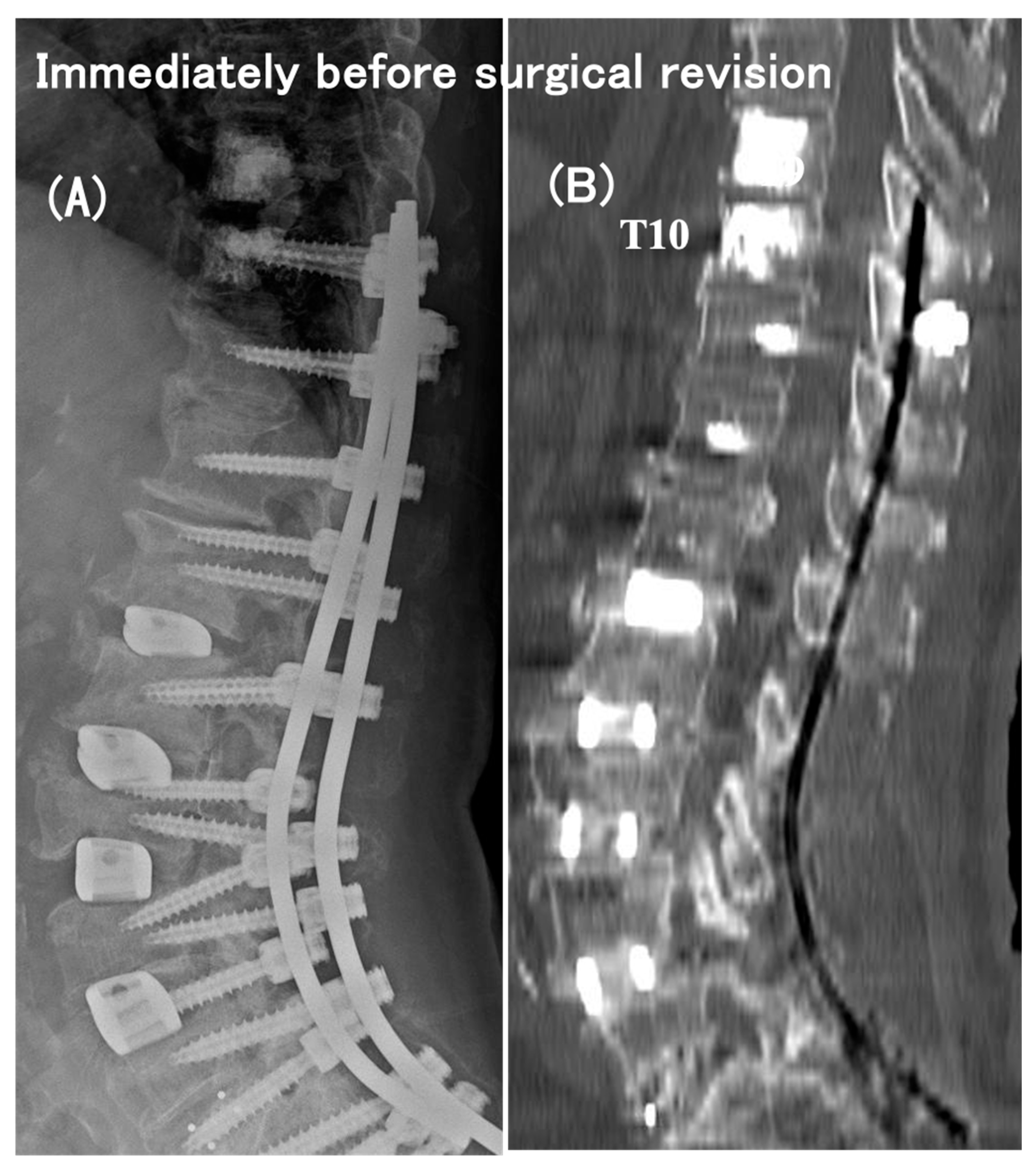 Medicina 60 00860 g002