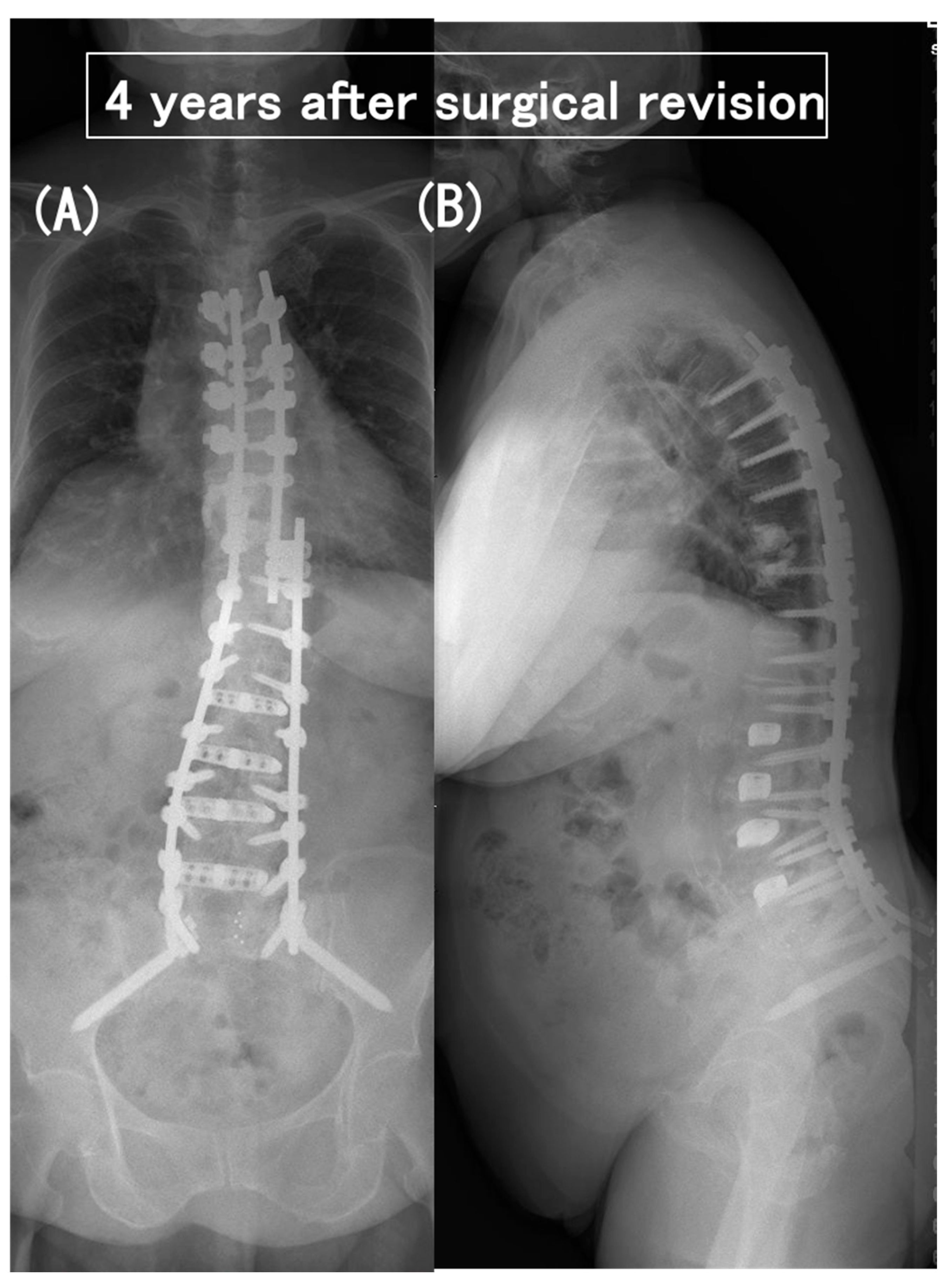 Medicina 60 00860 g005