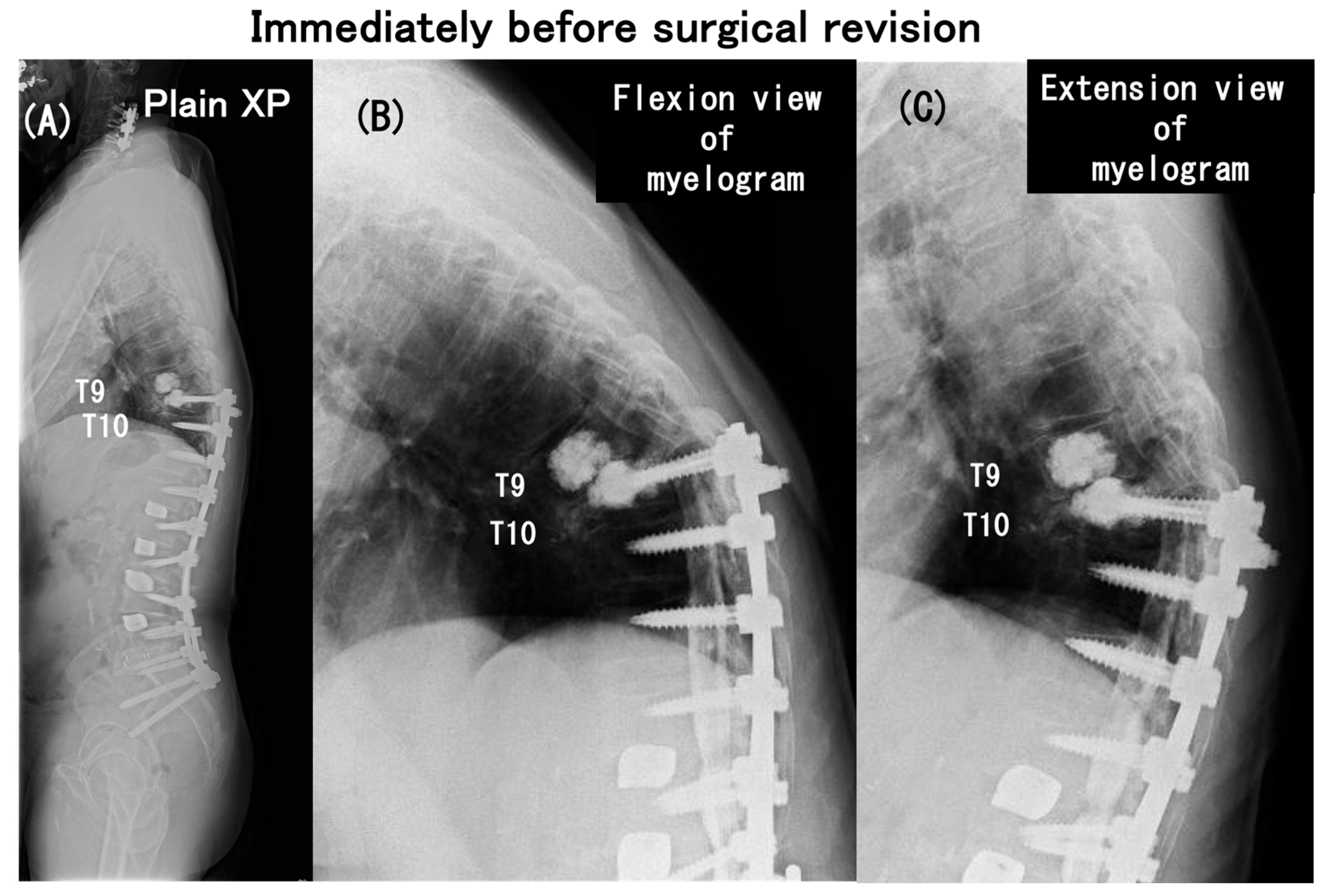 Medicina 60 00860 g007