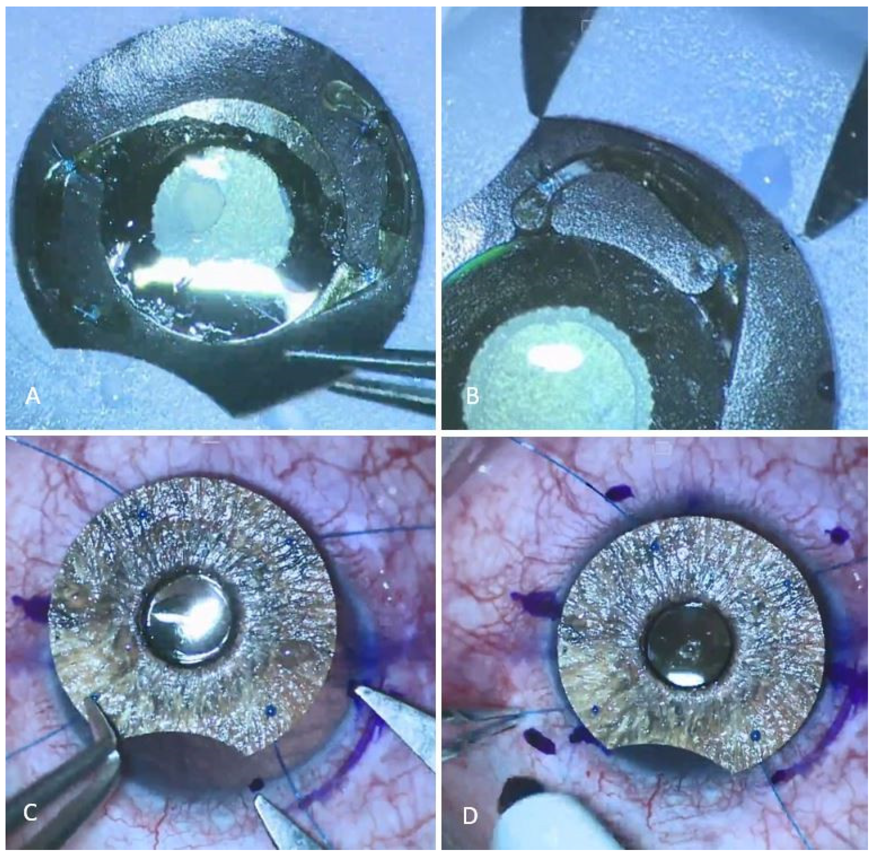 Medicina 60 00865 g001