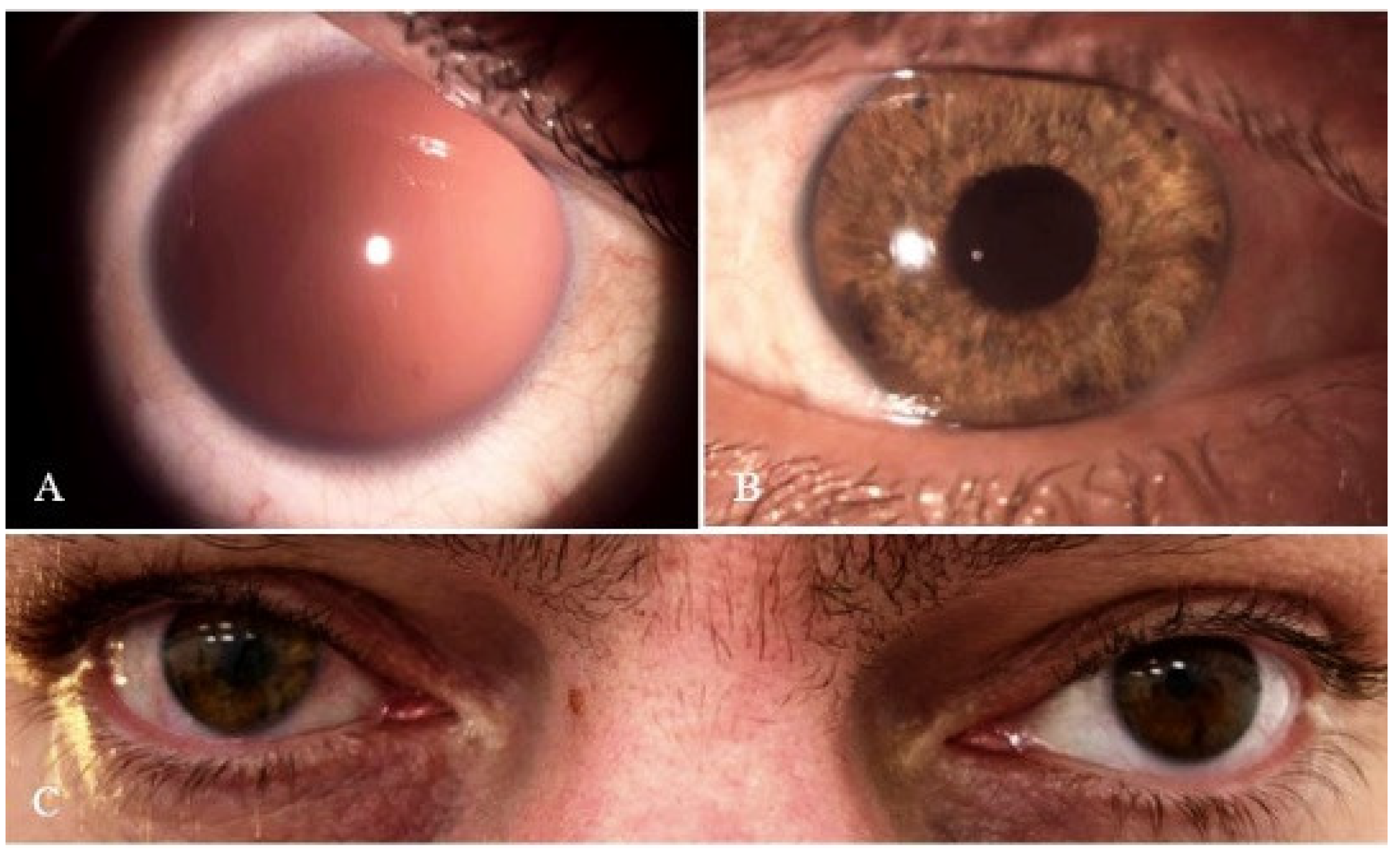 Medicina 60 00865 g002