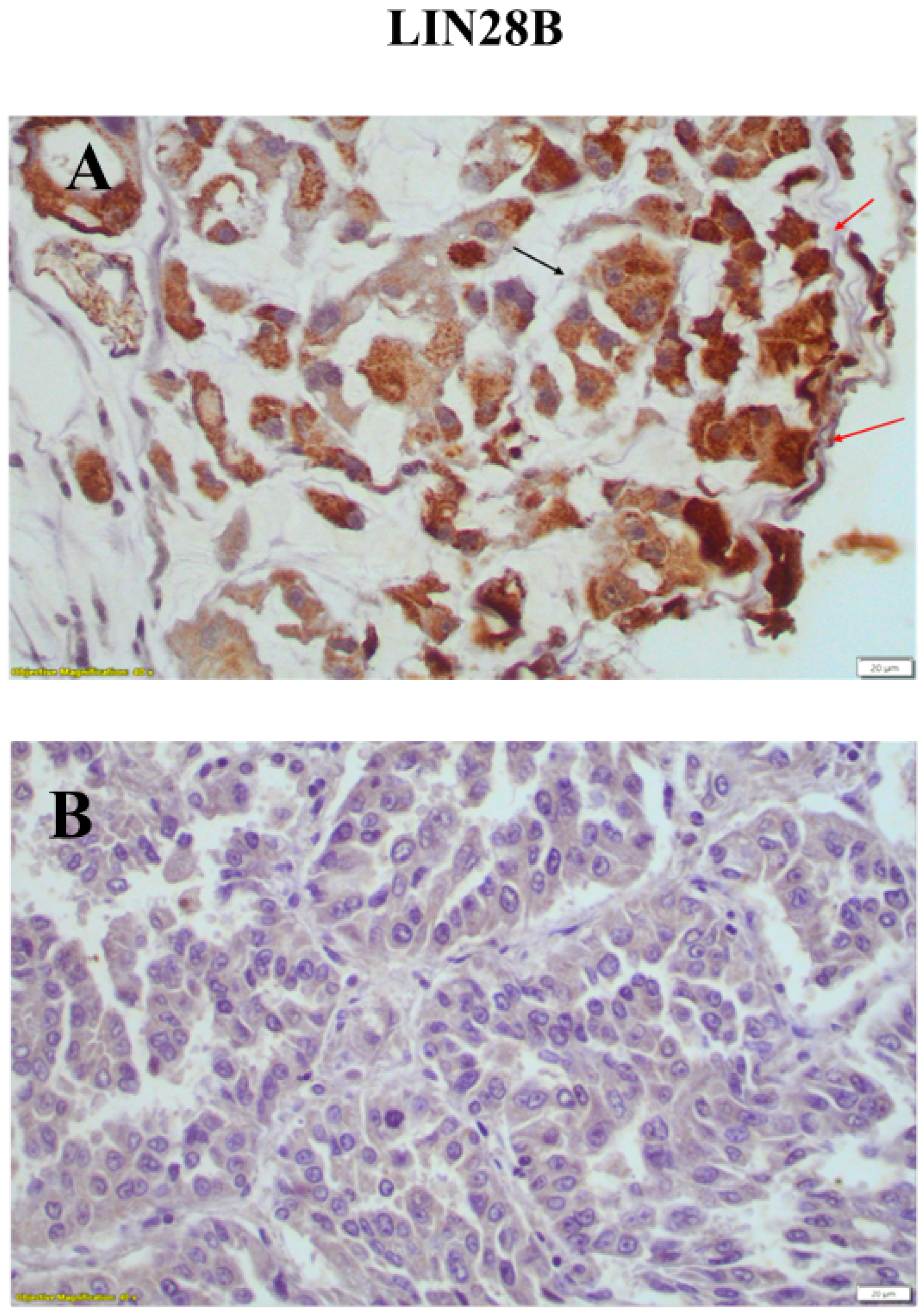 Medicina 60 00870 g005