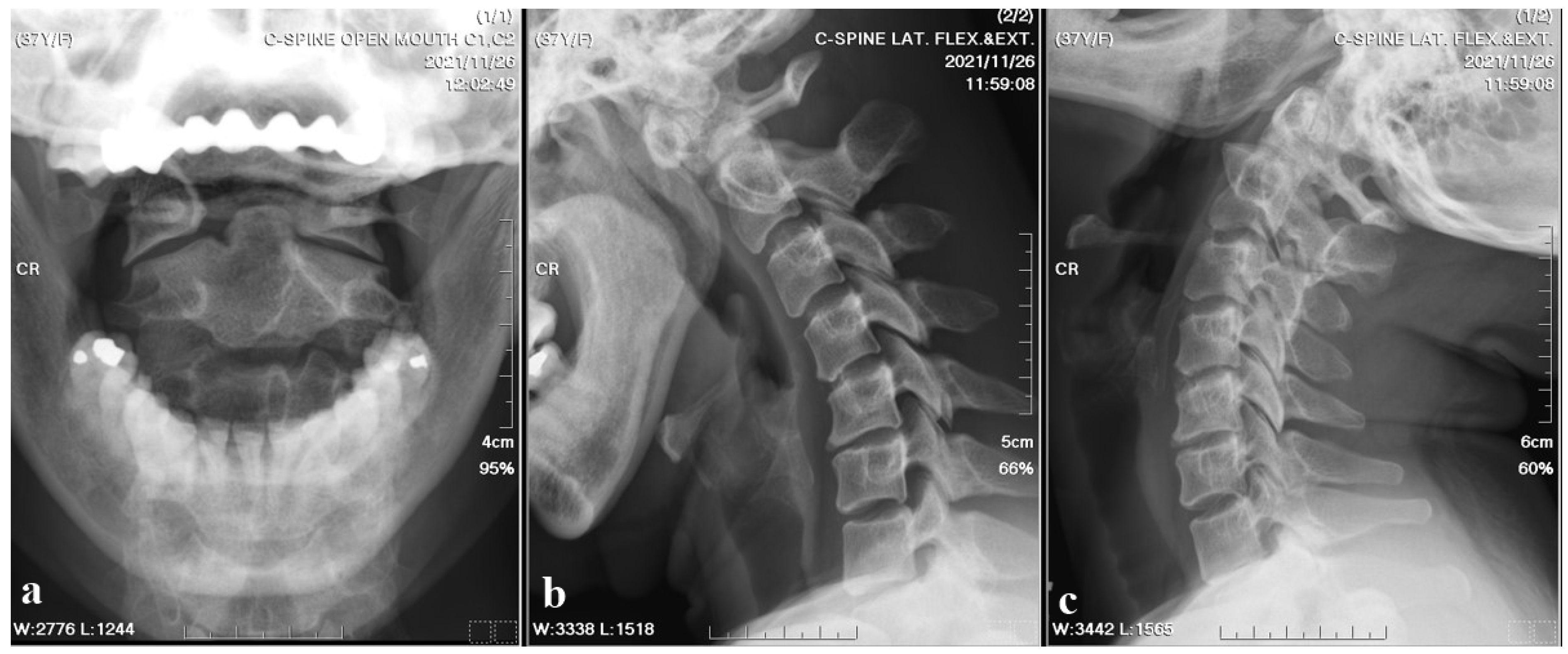 Medicina 60 00874 g001