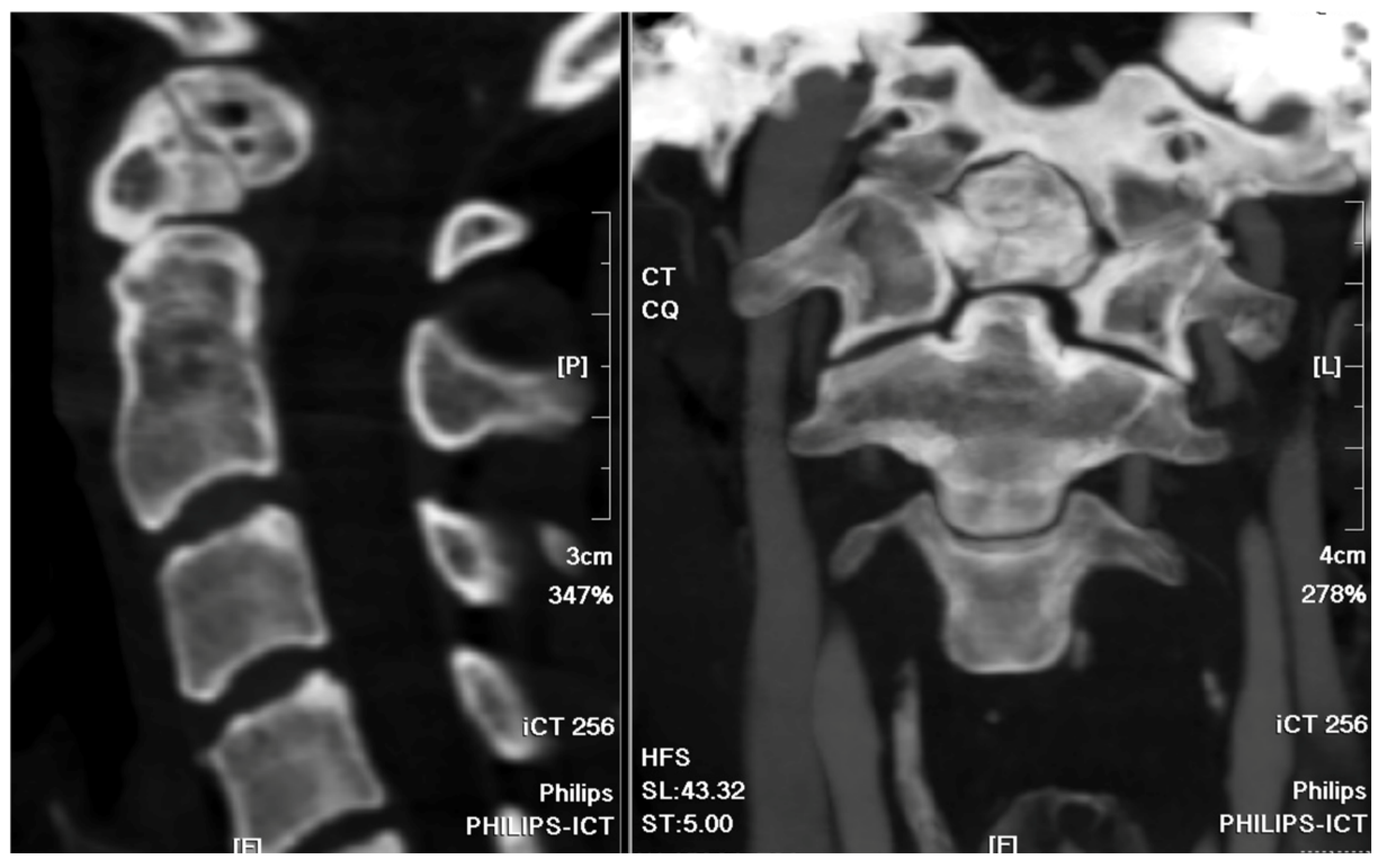 Medicina 60 00874 g002