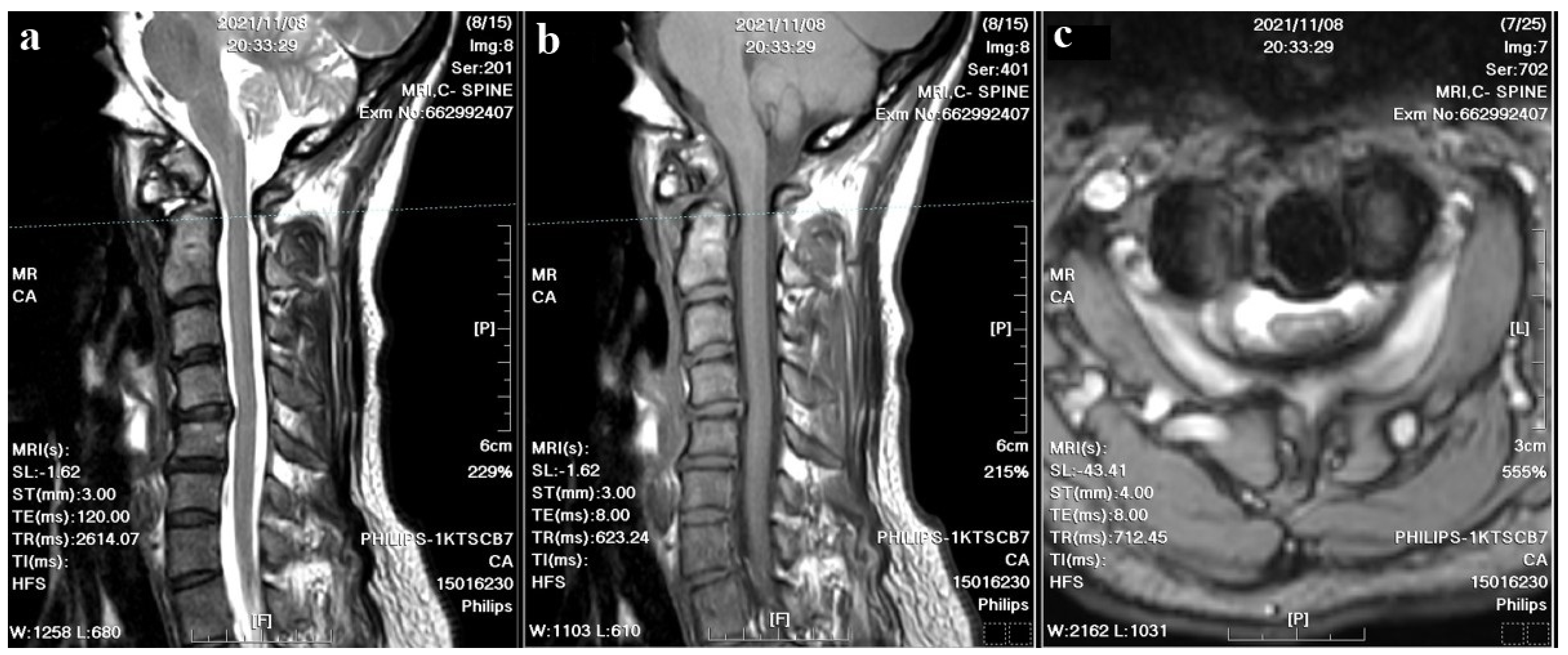 Medicina 60 00874 g003