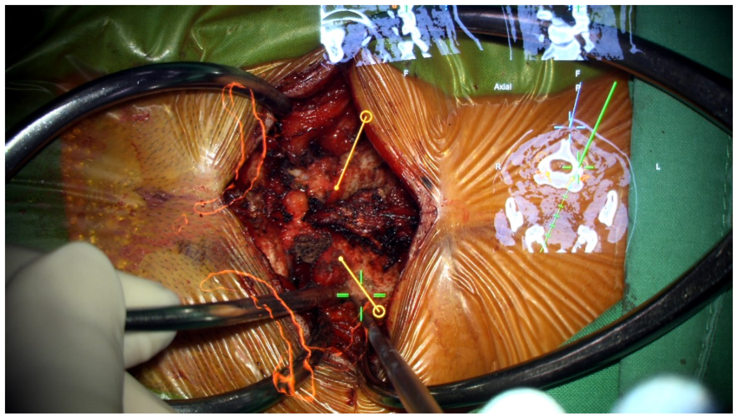 Medicina 60 00874 g005