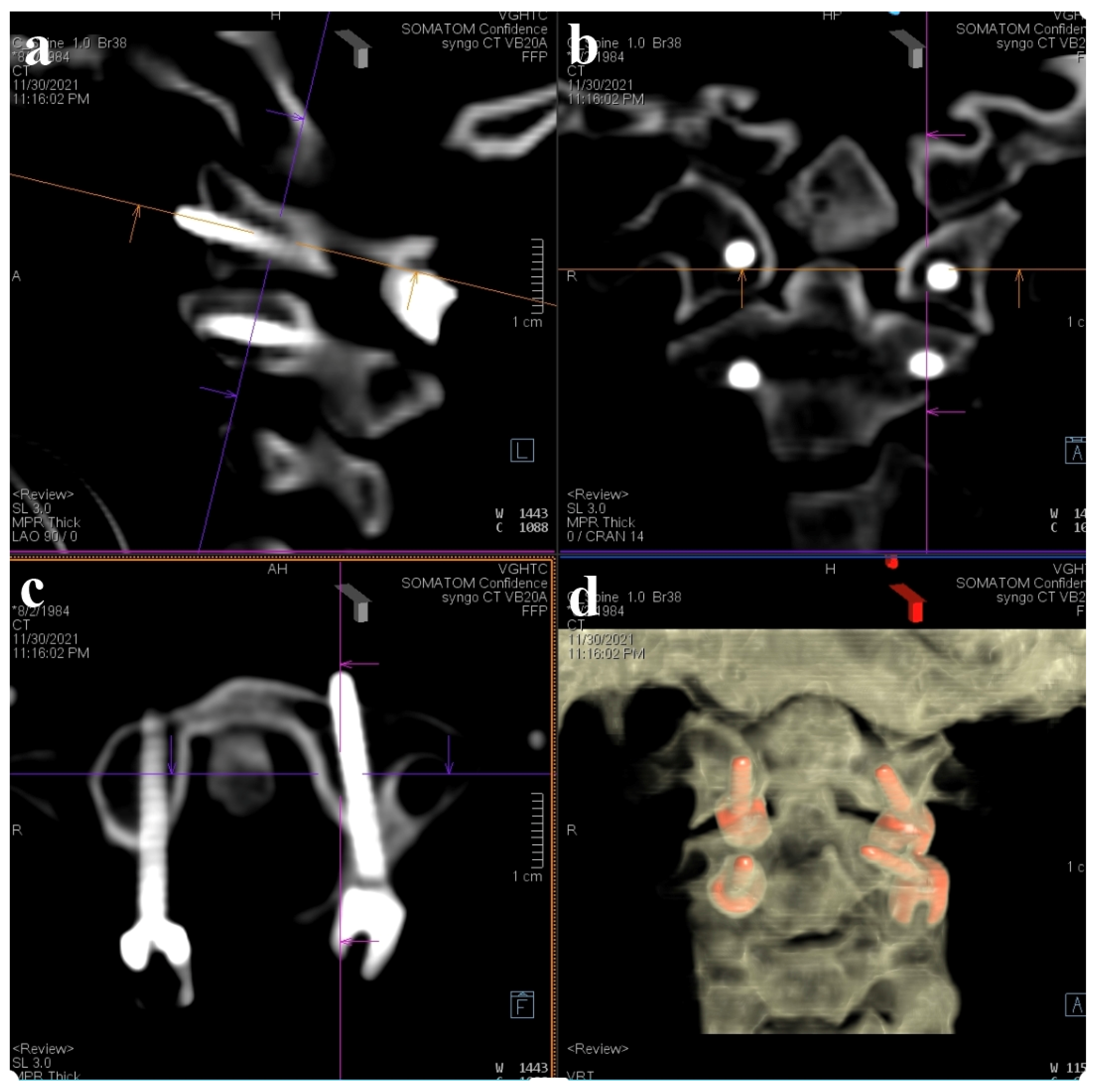 Medicina 60 00874 g006