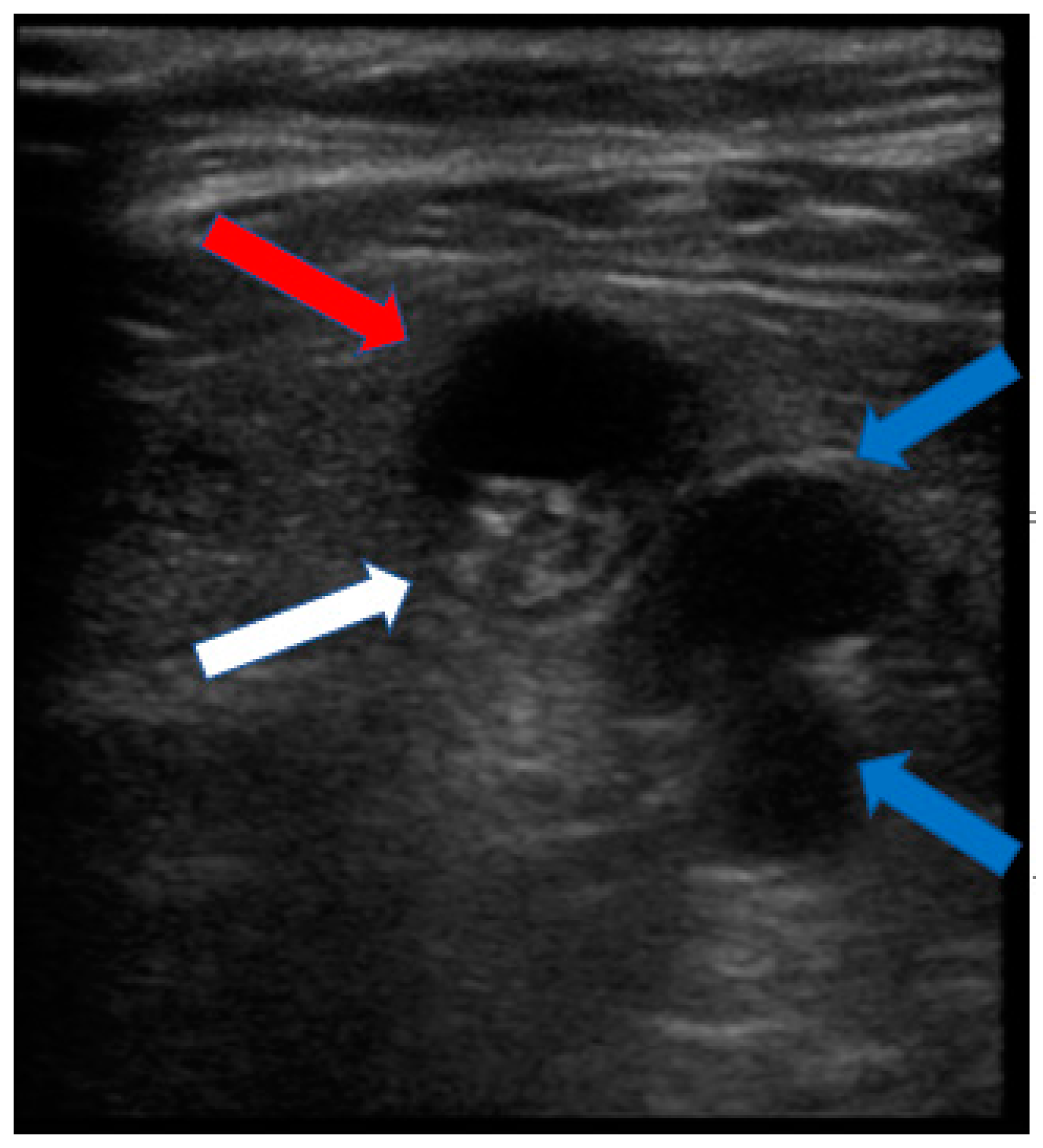 Medicina 60 00876 g003