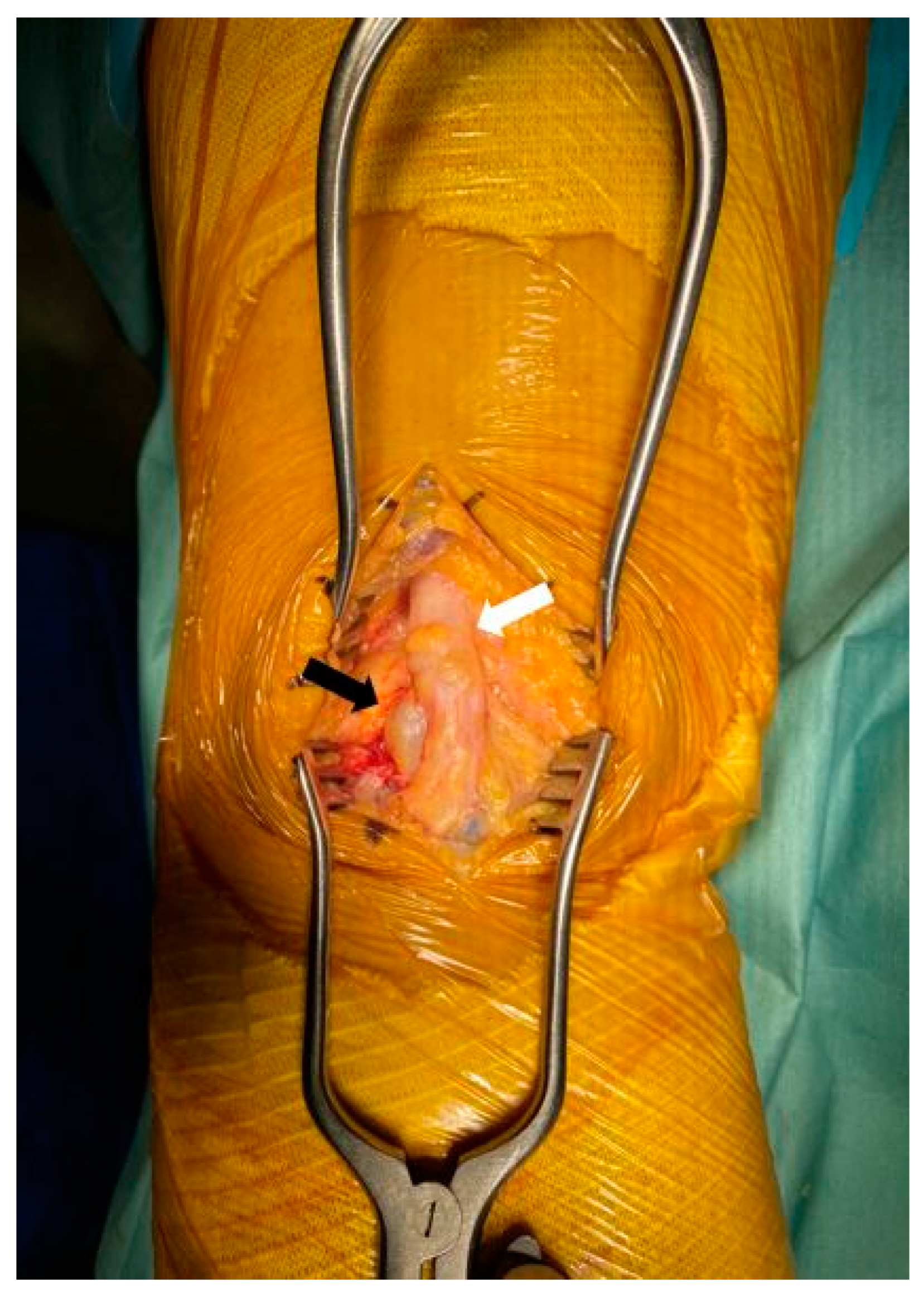 Medicina 60 00876 g007