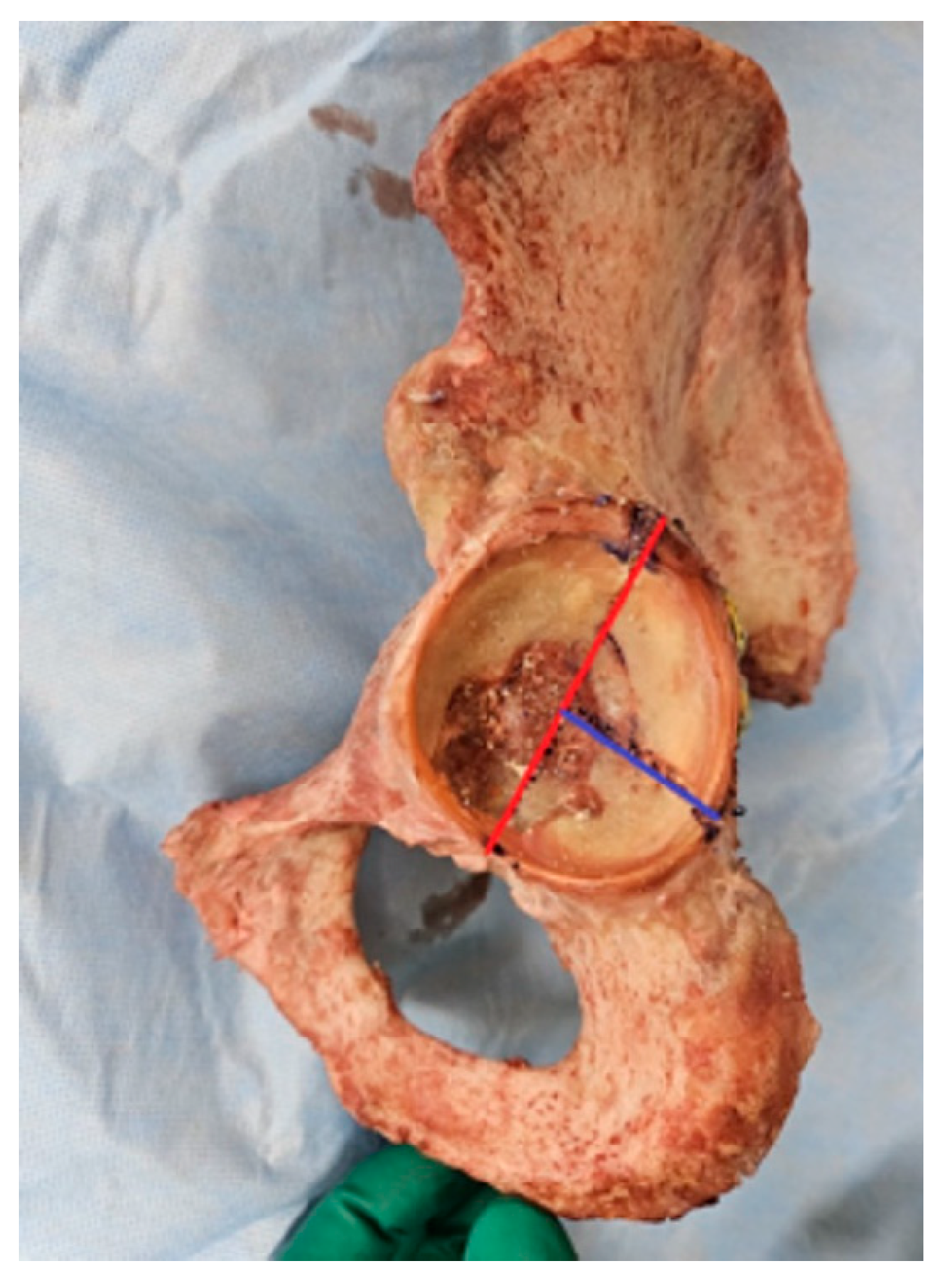 Medicina 60 00882 g004