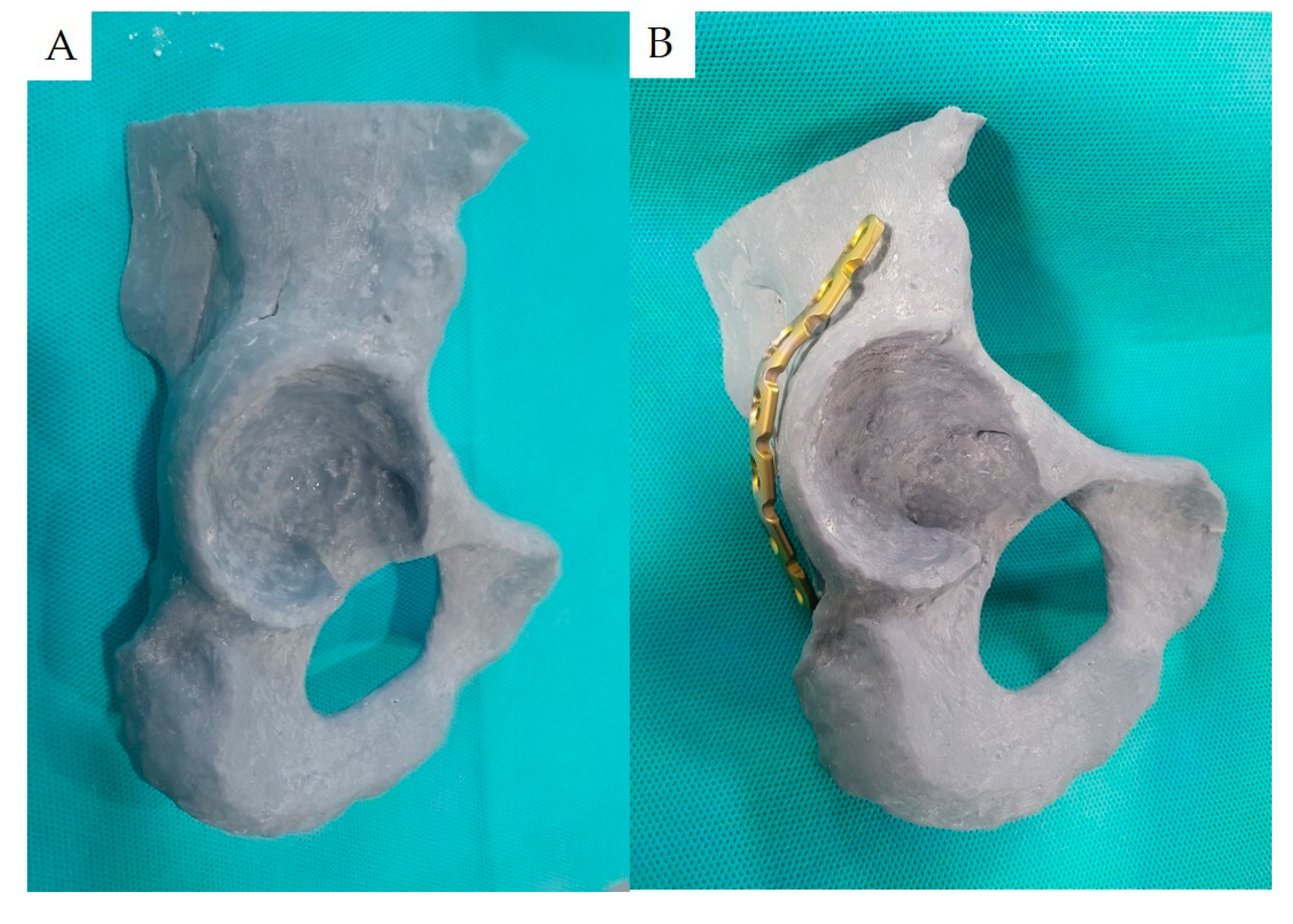 Medicina 60 00882 g005