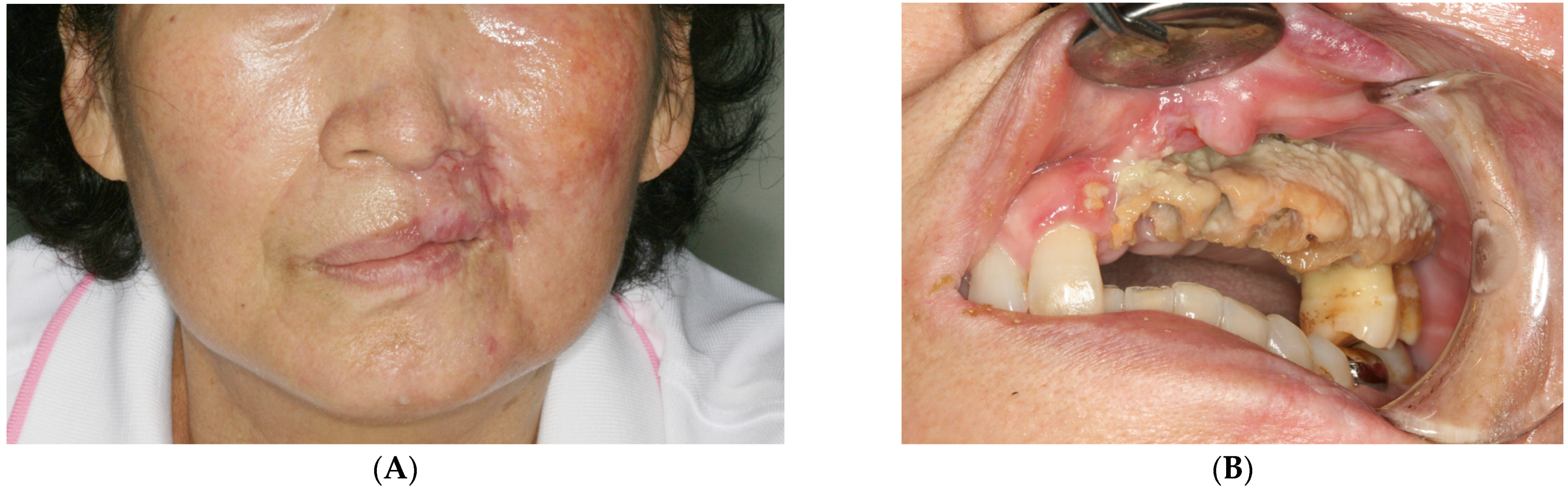 Medicina 60 00883 g001