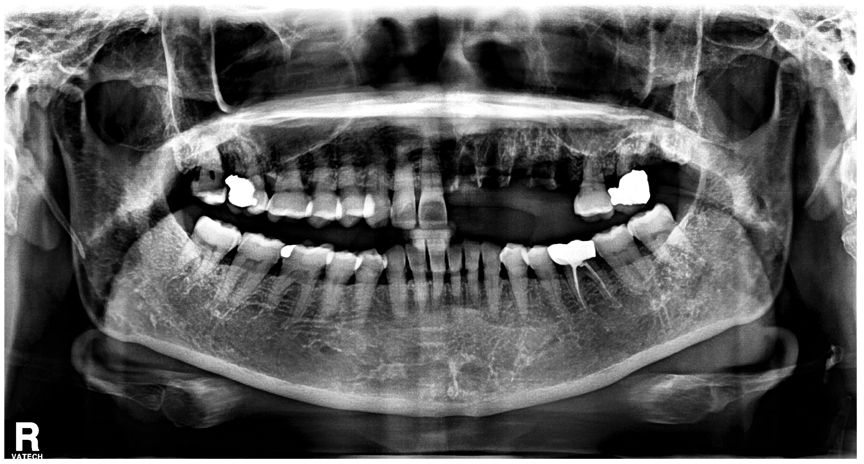 Medicina 60 00883 g002