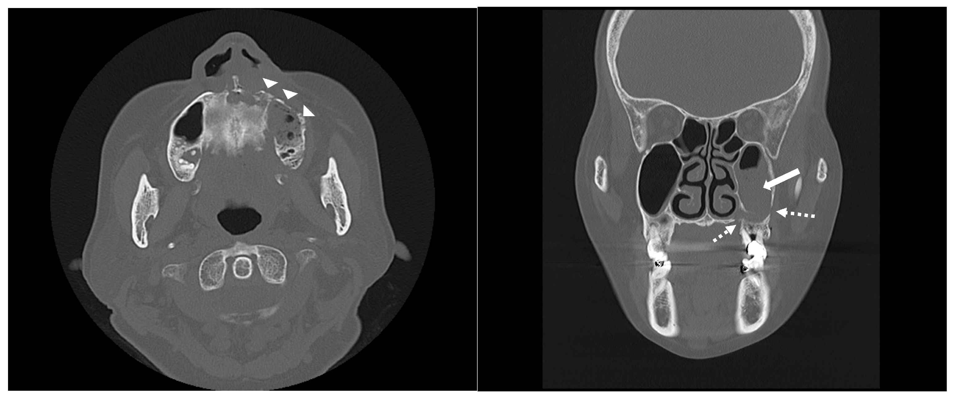 Medicina 60 00883 g003