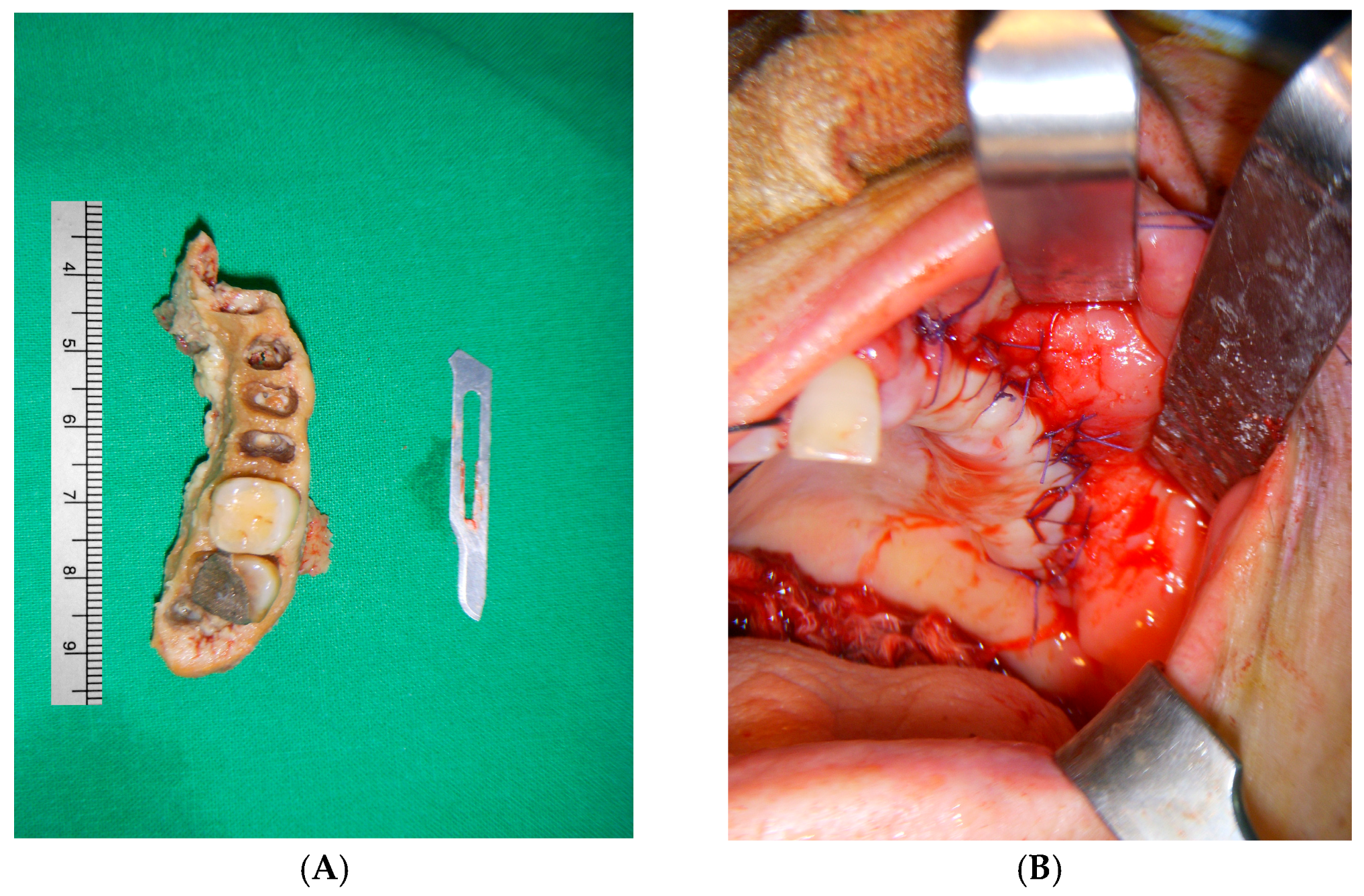 Medicina 60 00883 g004