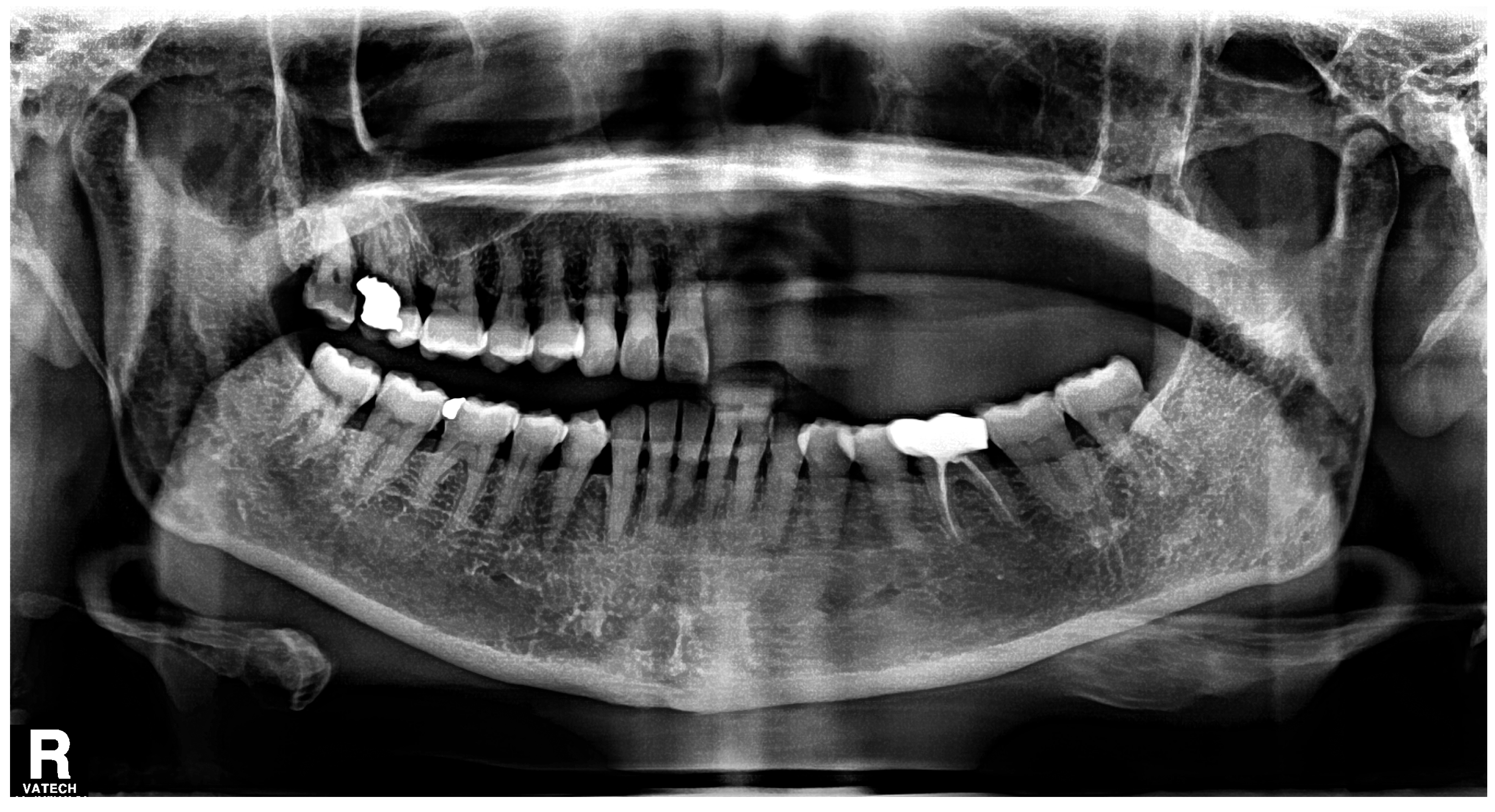 Medicina 60 00883 g005