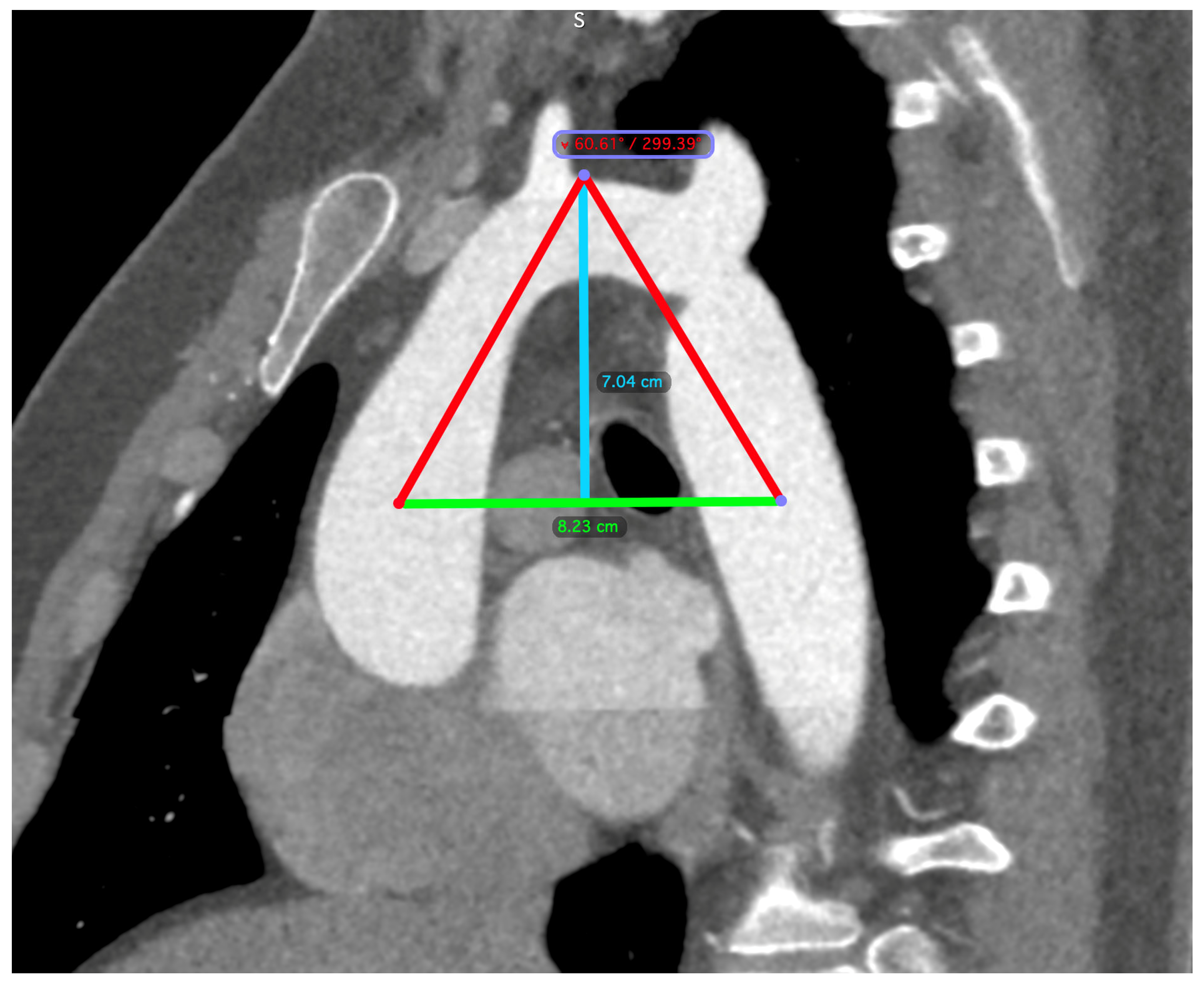 Medicina 60 00886 g002
