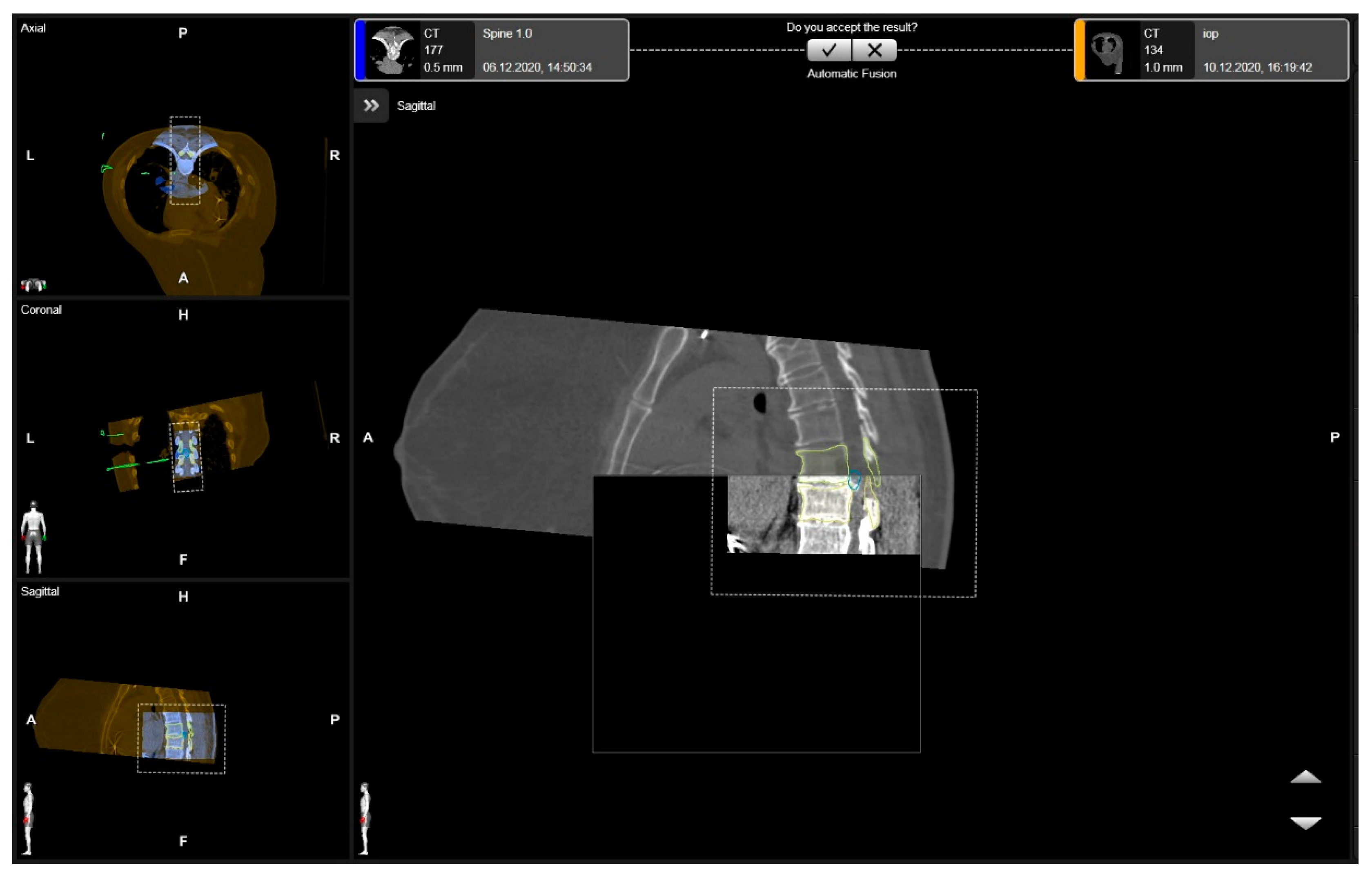 Medicina 60 00887 g003