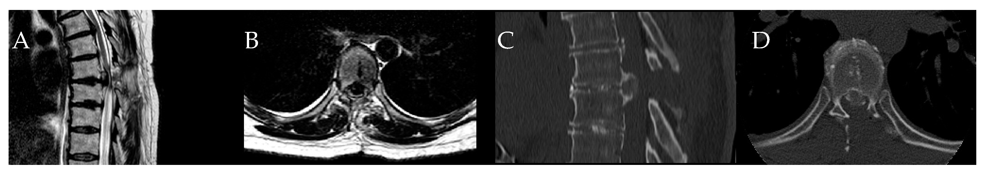 Medicina 60 00887 g006