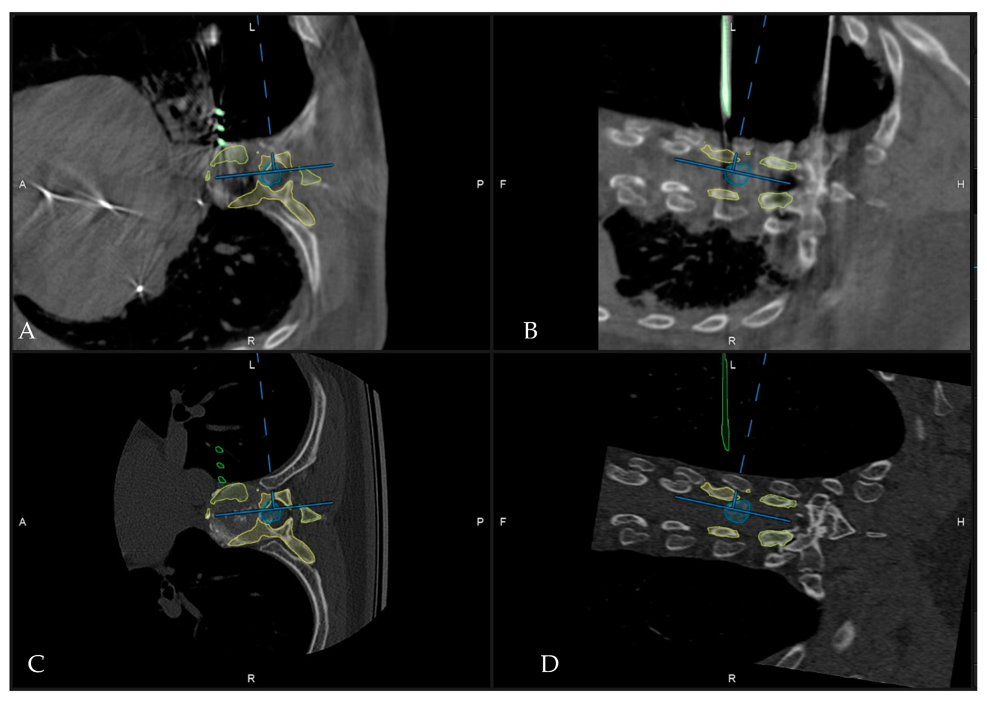 Medicina 60 00887 g007