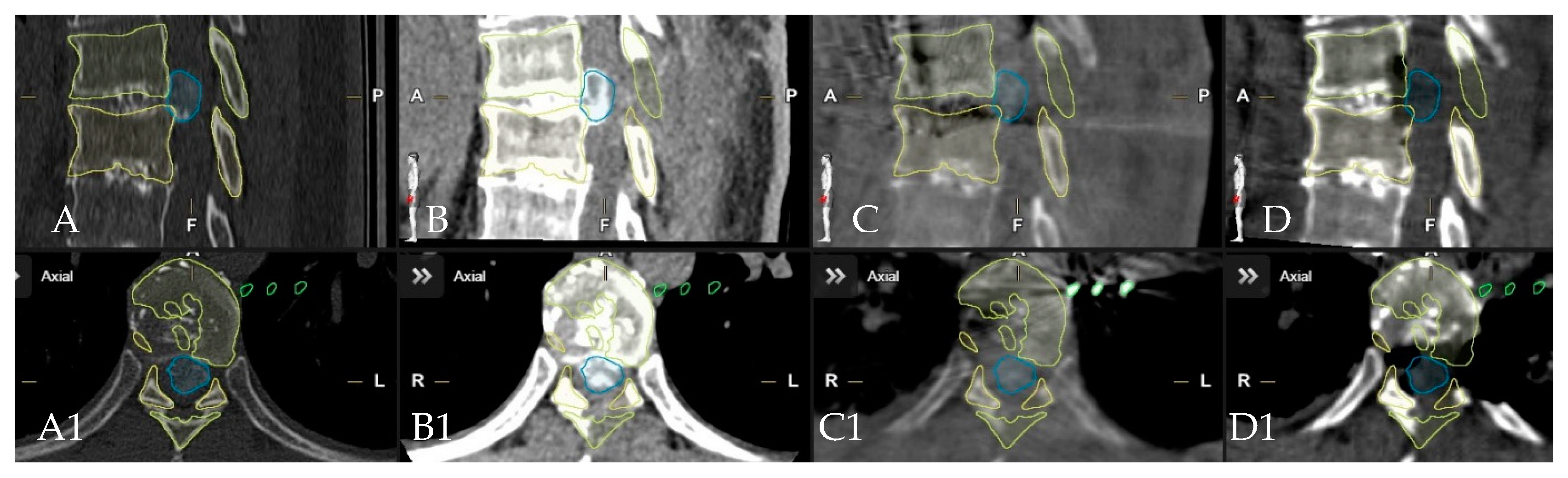 Medicina 60 00887 g008