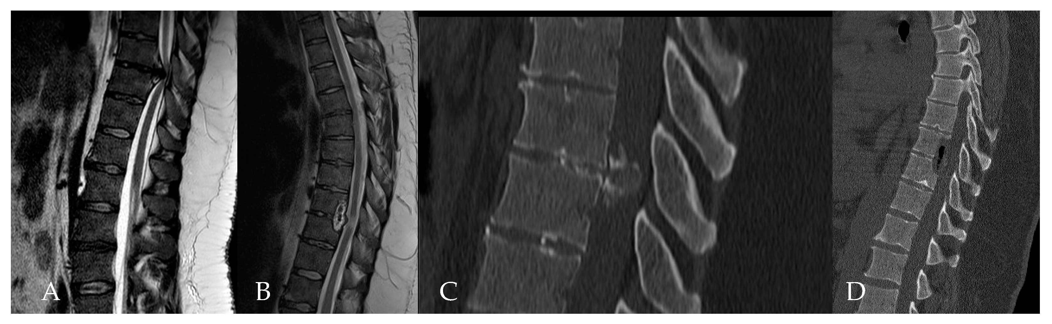 Medicina 60 00887 g009
